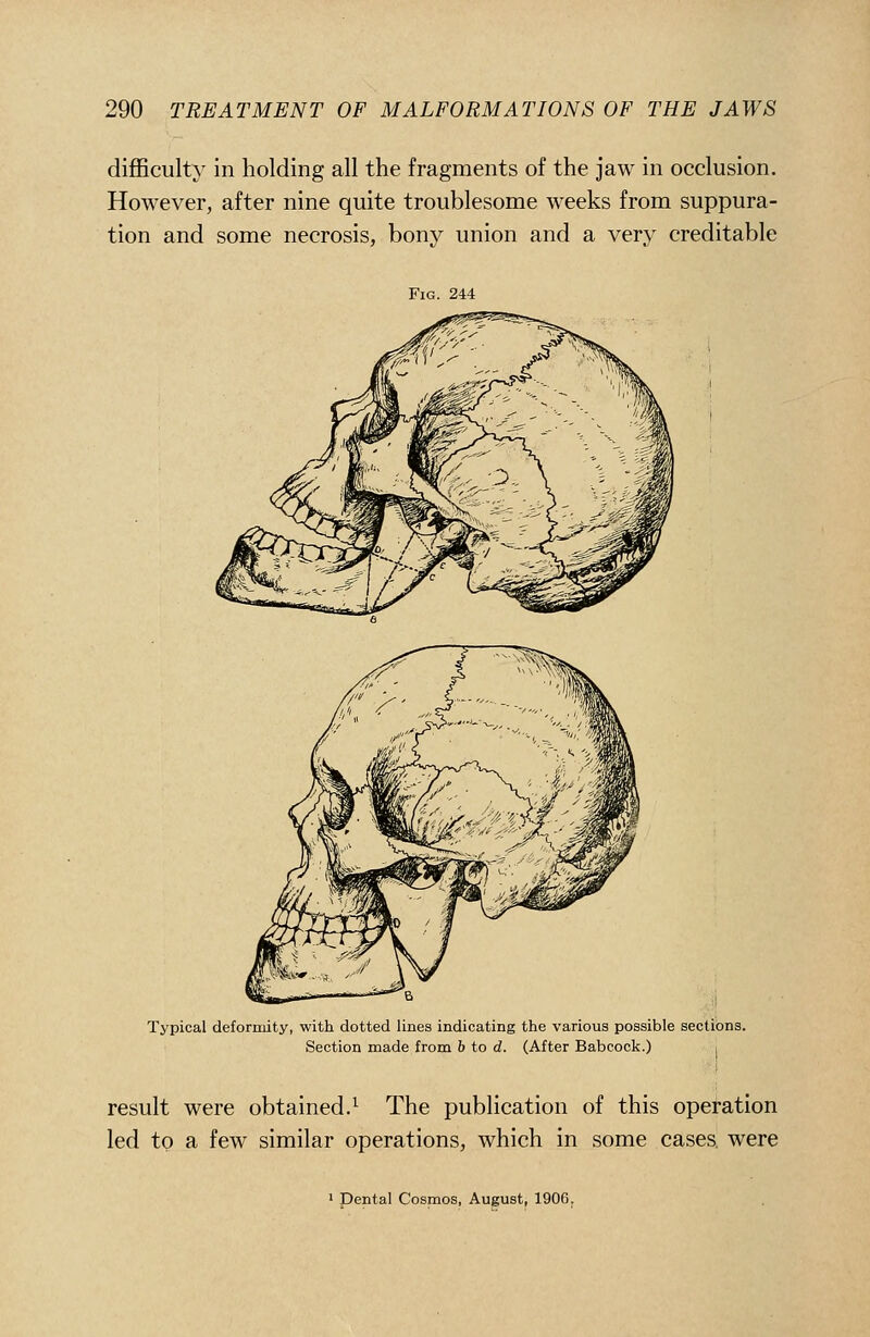 difficulty in holding all the fragments of the jaw in occlusion. However, after nine quite troublesome weeks from suppura- tion and some necrosis, bony union and a very creditable Fig. 244 Typical deformity, with dotted lines indicating the various possible sections. Section made from b to d. (After Babcock.) result were obtained.^ The publication of this operation led to a few similar operations, which in some cases were I Dental Cosmos, August, 1906.