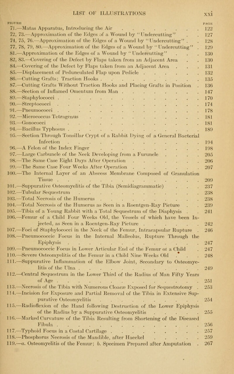 KICURE PMiK 71.—Matas Apparatus, Inlrodiiciiif^ (ho Air 122 72, 73.—Approximation of the lOdgcs of a Wound by Undercutting . . 127 74, 75, 70.—Api)roxiniation of the J']dges of a Wound by Undercutting . . 128 77, 78, 7'.), 80.—Approximation of the lulges of a Wound by  Undercutting . 129 81.-—Approximation of the Edges of a Wound by Undercutting . . . 130 82, 83.—Covering of the Defc-ct l)y Flaps taken from an Adjacent Area . . 130 84.—(Jovcring of the Defect by Fhips taken from an Adjacent Area . . . 131 85.—Displacement of Pedunculated Flap upon I'etlicle 132 86.—Cutting Grafts; Traction Hooks 135 87.—Cutting Grafts Without Traction Hooks and Placing Grafts in Position . 136 88.—-Section of Inflamed Omentum from Man 147 8i).—Stai)hylococci 170 90.-—Streptococci 174 91.—Pneumococci 178 92.—Micrococcus Tetragenus 181 93.—(ionococci 181 94.—Bacillus Typhosus 189 95.—Section Through Tonsillar Crypt of a Hablnt Dying of a General Bacterial Infection 194 96.—A Felon of the Index Finger 198 97.—Large Carbuncle of the Neck Developing from a Furuncle .... 205 98.—The Same Case Eight Days After Operation 206 99.—The Same Case Four Weeks After Operation 207 100.—The Internal Layer of an Abscess Membrane Composed of CJraiudation Tissue 209 101.—Suppurative Osteomyelitis of the Tibia (Semidiagranunatic) . . . 237 102.—Tubular Sequestrum 238 103.—^I'otal Necrosis of the Ilimierus 238 104.—^Total Necrosis of the Hvmierus as Seen in a Roentgen-Ray Picture . . 239 105.—Tibia of a Young Rai)bit with a Total Sequestrum of the Diaphysis . . 241 106.—-Femur of a Child Four Weeks Old, the Vessels of Avhich have been In- jected, as Seen in a Roentgen-Ray Picture 242 107.—Foci of Staphylococ(;i in the Neck (jf the Femur, Intracapsular Rujiture . 246 108.—Pneumococcic Focus in the Internal Malleolus, Rupture Through the Epiphysis 247 109.—Pneumococcic Focus in Lower Articular End of the Femur or a (Jhild . 247 I 10.—Severe Osteomyelitis of the Femur in a Child Nine Weeks Old . . . 248 111.—Suppurative Inflanunation of the Elbow Joint, Secondary to Osteomye- litis of the Ulna 249 112.—Central Sequestrum in the Lower Third of the Radius of Man Fifty Years of Age 251 113.—Necrosis of the Tibia with Numerous Cloaca? Exposed for Secjuestrotomy . 253 114.—Incision for Exposure and Partial Removal of the Tibia in Extensive Sup- purative Osteomyelitis 254 115.—Radioflexion of the Hand following Destruction of the Lower Epiphysis of the Radius by a Suppurative Osteomyelitis 255 116.—Marked Curvature of the Til)ia Resulting from Shortening of the Diseased Fibula 256 117.—Tjqihoid Focus in a Costal ('artiliige 257 118.—Phosphorus Necrosis of the Mandible, after Haeckel 259 119.—a. Osteomyelitis of the Femur; J;. Specimen Prepared after Amputation . 267