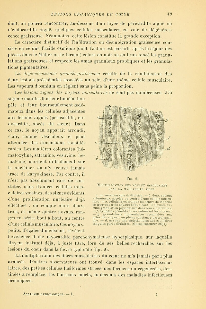 / dant, on pourra rencontrer, au-dessous d'un foyer de péricardite aiguë ou dendocardite aiguë, quelques cellules musculaires en voie de dégénéres- cence graisseuse. Néanmoins, cette lésion constitue la grande exception. Le caractère distinctif de l'infiltration ou désintégration graisseuse con- siste en ce que l'acide osmique (dont l'action est parfaite après le séjour des pièces dans le Millier ou le formol) colore en noir ou en brun foncé les granu- lations graisseuses et respecte les amas granuleux protéiques et les granula- tions pigmentaires. La dégénérescence granulo-graisseiise résulte de la combinaison des deux lésions précédentes associées au sein d'une même cellule musculaire. Les vapeurs d'osmium en règlent sans peine la proportion. Les lésions aiguës des noj'aax musculaires ne sont pas nombreuses. J'ai signalé maintes fois leur tuméfaction pâle et leur boursouflement œdé- ,wf, mateux dans les cellules adjacentes aux lésions aiguës (péricardite, en- docardite, abcès du cœur). Dans ce cas, le noyau apparaît arrondi, clair, comme vésiculeux, et peut atteindre des dimensions considé- rables. Les matières colorantes (hé- matoxyline, safranine, vésuvine, hé- matéine) mordent difficilement sur la nucléine ; on n'y trouve jamais trace de karyokinèse. Par contre, il n'est pas absolument rare de con- stater, dans d'autres cellules mus- culaires voisines, des signes évidents d'une prolifération nucléaire déjà effectuée : on compte alors deux, trois, et même quatre noyaux ran- gés en série, bout à bout, au centre d'une cellule musculaire. Ces noyaux, petits, d'égales dimensions, révèlent l'existence d'une myocardite parenchymateuse hyperplasique, sur laquelle Hayem insistait déjà, à juste titre, lors de ses belles recherches sur les lésions du cœur dans la fièvre typhoïde (fig. 9). La multiplication des fibres musculaires du cœur ne m'a jamais paru plus avancée. D'autres observateurs ont trouvé, dans les espaces interfascicu- laires, des petites cellules fusiformes striées, néo-formées ou régénérées, des- tinées à remplacer les faisceaux morts, au déeours des maladies infectieuses prolongées. /_ Fig. 9. Multiplication des xoyaux musculaires DANS LA iMyocaudite aiguë. a, un noyau en voie de division. — b, deux noyaux volumineux accolés au centre d'une cellule muscu- laire. — c, cellule myocardique au centre de laquelle se trouvent trois noyaux bout à bout; il n'existe au- cune granulation pigmentaire dans leurs intervalles. — f, cylindres primitifs striés entourant les noyaux. — ,7, granulations pigmentaires accumulées aux pôles des noyaux, en pleine substance protoplasmi- que. — d, noyaux des endothéliums des capillaires sanguins péri'cellulaires. (Grossissement 400/1). Anatoiue pathologique. — I.