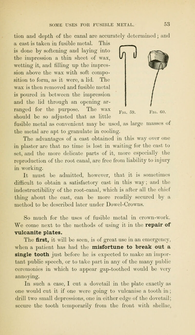 tion and depth of the canal are accurately determined; and a cast is taken in fusible metal. This is done by softening and laying into j the impression a thin sheet of wax, v U wetting it, and filling up the impres- sion above the wax with soft compo- sition to form, as it were, a lid. The wax is then removed and fusible metal is poured in between the impression and the lid through an opening ar- ranged for the purpose. The wax piQ .^ piQ 6Q should be so adjusted that as little fusible metal as convenient may be used, as large masses of the metal are apt to granulate in cooling. The advantages of a cast obtained in this way over one in plaster are that no time is lost in waiting for the cast to set, and the more delicate parts of it, more especially the reproduction of the root canal, are free from liability to injury in working. It must be admitted, however, that it is sometimes difficult to obtain a satisfactory cast in this way; and the indestructibility of the root-canal, which is after all the chief thing about the cast, can be more readily secured by a method to be described later under Dowel-Crowns. So much for the uses of fusible metal in crown-work. We come next to the methods of using it in the repair of vulcanite plates. The first, it will be seen, is of great use in an emergency, when a patient has had the misfortune to break out a single tooth just before he is expected to make an impor- tant public speech, or to take part in any of the many public ceremonies in which to appear gap-toothed would be very annoying. In such a case, I cut a dovetail in the plate exactly as one would cut it if one were going to vulcanise a tooth in; drill two small depressions, one in either edge of the dovetail; secure the tooth temporarily from the front with shellac,