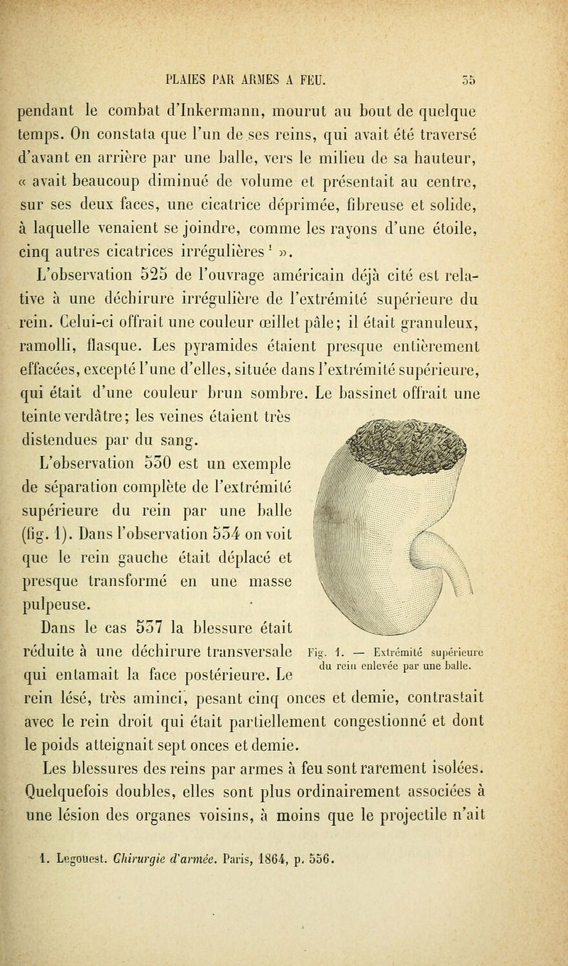 pendant le combat d'inkermann, mourut au bout de quelque temps. On constata que l'un de ses reins, qui avait été traversé d'avant en arrière par une balle, vers le milieu de sa hauteur, (c avait beaucoup diminué de volume et présentait au centre, sur ses deux faces, une cicatrice déprimée, fibreuse et solide, à laquelle venaient se joindre, comme les rayons d'une étoile, cinq autres cicatrices irrégulières' «. L'observation 525 de l'ouvrage américain déjà cité est rela- tive à une déchirure irrégulière de l'extrémité supérieure du rein. Celui-ci offrait une couleur œillet pâle; il était granuleux, ramolli, flasque. Les pyramides étaient presque entièrement effacées, excepté l'une d'elles, située dans l'extrémité supérieure, qui était d'une couleur brun sombre. Le bassinet offrait une teinte verdâtre; les veines étaient très distendues par du sang. L'observation 530 est un exemple de séparation complète de l'extrémité supérieure du rein par une balle (fig. 1). Dans l'observation 554 on voit que le rein gauche était déplacé et presque transformé en une masse pulpeuse. Dans le cas 557 la blessure était V,__ _,. ' réduite à une déchirure transversale Fig. d. — Extrémité supérieure ., , p , . T du rein enlevée par une balle. qui entamait la lace postérieure. Le rein lésé, très aminci, pesant cinq onces et demie, contrastait avec le rein droit qui était partiellement congestionné et dont le poids atteignait sept onces et demie. Les blessures des reins par armes à feu sont rarement isolées. Quelquefois doubles, elles sont plus ordinairement associées à une lésion des organes voisins, à moins que le projectile n'ait 1. Legouest. Chirurgie d'armée. Paris, 1864, p. 556.