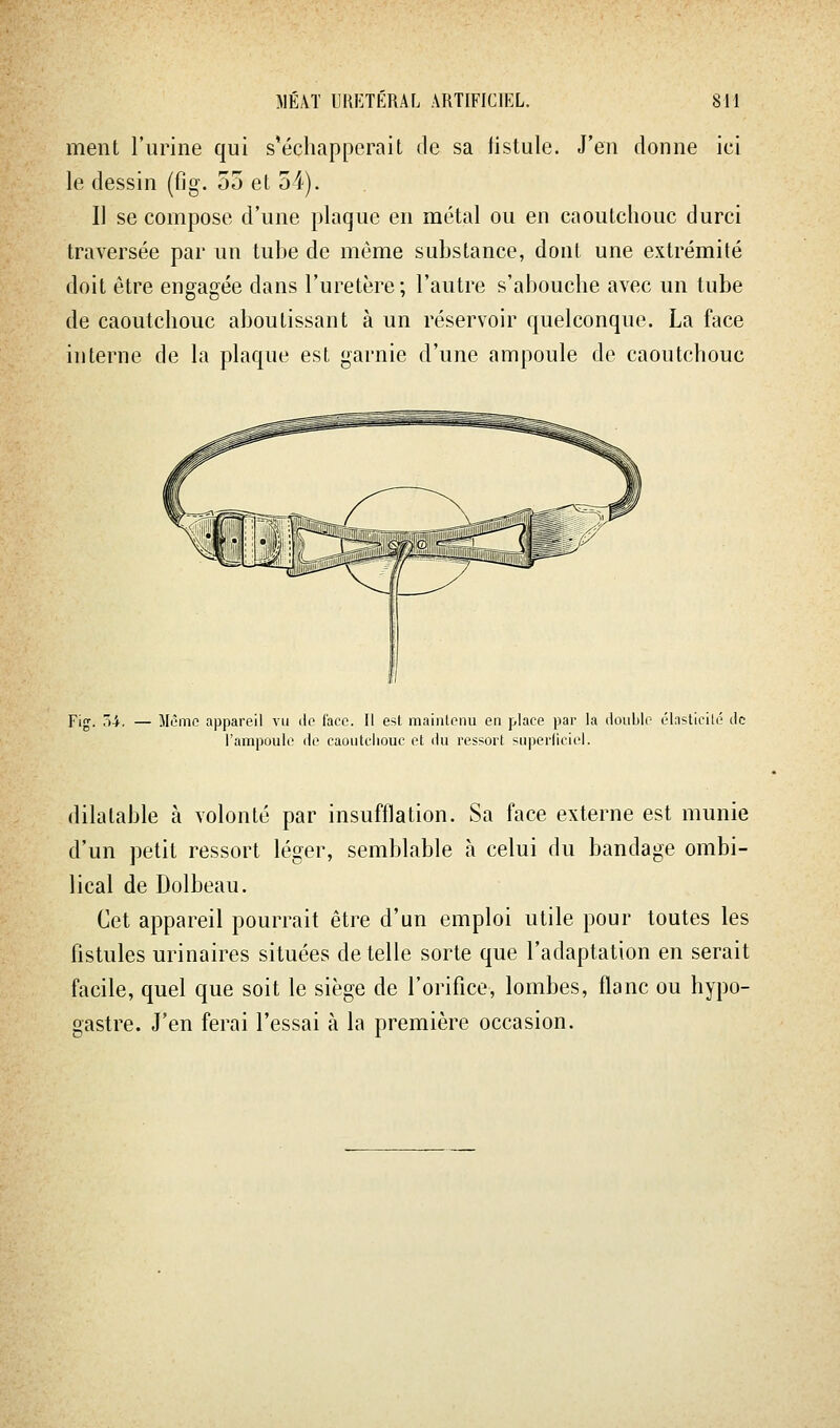 ment l'urine qui s'échapperait de sa fistule. J'en donne ici le dessin (fig. 55 et 54). Il se compose d'une plaque en métal ou en caoutchouc durci traversée par un tuhe de même substance, dont une extrémité doit être engagée dans l'uretère; l'autre s'abouche avec un tube de caoutchouc aboutissant à un réservoir quelconque. La face interne de la plaque est garnie d'une ampoule de caoutchouc Fig. ~>i. — Môme appareil vu ilc face. Il est maintenu en place par la rlouble élasticité de l'ampoule de caoutchouc et du ressort superliciel. dilatable à volonté par insufflation. Sa face externe est munie d'un petit ressort léger, semblable à celui du bandage ombi- lical de Dolbeau. Cet appareil pourrait être d'un emploi utile pour toutes les fistules urinaires situées dételle sorte que l'adaptation en serait facile, quel que soit le siège de l'orifice, lombes, flanc ou hypo- gastre. J'en ferai l'essai à la première occasion.