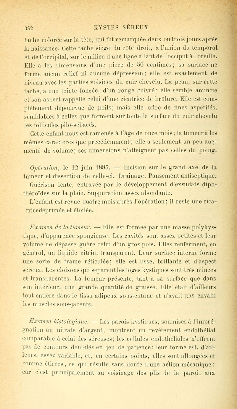 tache colorée sur la tête, qui fut remarquée deux ou trois jours après la naissance. Cette tache siège du côté droit, à l'union du temporal et de l'occipital, sur le milieu d'une ligne allant de l'occiput à l'oreille. Elle a les dimensions d'une pièce de 50 centimes; sa surface ne forme aucun relief ni aucune dépression ; elle est exactement de niveau avec les parties voisines du cuir chevelu. La peau, sur cette tache, a une teinte foncée, dun rouge cuivré ; elle semble amincie et son aspect rappelle celui d'une cicatrice de brûlure. Elle est com- plètement dépourvue de poils; mais elle offre de fines aspérités, semblables à celles que forment sur toute la surface du cuir chevelu les follicules pilo-sébacés. Cette enfant nous est ramenée à l'âge de onze mois; la tumeur a les mêmes caractères que précédemment ; elle a seulement un peu aug- menté de volume ; ses dimensions n'atteignent pas celles du poing. Opération, le 12 juin 1885. — Incision sur le grand axe de la tumeur et dissection de celle-ci. Drainage. Pansement antiseptique. Guérison lente, entravée par le développement d'exsudais diph- théroïdes sur la plaie. Suppuration assez abondante. L'enfant est revue quatre mois après l'opération; il reste une cica- tricedéprimée et étoilée. Examen de la tumeur. — Elle est formée par une masse polykys- tique, d'apparence spongieuse. Les cavités sont assez petites et leur volume ne dépasse guère celui d'un gros pois. Elles renferment, en général, un liquide citrin, transparent. Leur surface interne forme une sorte de trame réticulée; elle est lisse, brillante et d'aspect séreux. Les cloisons qui séparent les loges kystiques sont très minces et transparentes. La tumeur présente, tant à sa surface que dans son intérieur, une grande quantité de graisse. Elle était d'ailleurs tout entière dans le tissu adipeux sous-cutané et n'avait lias envahi les muscles sous-jacents. Examen histologique. — Les parois kystiques, soumises à l'impré- gnation au nitrate d'argent, montrent un revêtement endothélial comparable à celui des séreuses; les cellules endothéliales n'offrent pas de contours dentelés en jeu de patience ; leur forme est, d'ail- leurs, assez variable, et, en certains points, elles sont allongées et comme étirées, ce qui résulte sans doute d'une action mécanique : car c'est principalement au voisinage des plis de la paroi, aux