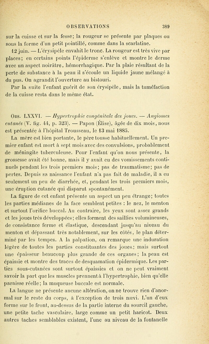 sur la cuisse et sur la fesse; la rougeur se présente par plaques ou sous la forme d'un petit pointillé, comme dans la scarlatine. 12 juin. — L'érysipèle envahit le tronc. La rougeur est très vive par places ; en certains points l'épiderme s'enlève et montre le derme avec un aspect noirâtre, hémorrhagique. Par la plaie résultant de la perte de substance à la peau il s'écoule un liquide jaune mélangé à du pus. On agrandit l'ouverture au bistouri. Par la suite l'enfant guérit de son érysipèle, mais la tuméfaction de la cuisse resta dans le même état. Obs. LXXVI. — Hyjoertrophie congénitale des joues. — Angiomes cutanés (V. fîg. 44, p. 323). — Papon (Élise), âgée de dix mois, nous est présentée à l'hôpital Trousseau, le 13 mai 1883. La mère est bien portante, le père tousse habituellement. Un pre- mier enfant est mort à sept mois avec des convulsions, probablement de méningite tuberculeuse. Pour l'enfant qu'on nous présente, la grossesse avait été bonne, mais il y avait eu des vomissements conti- nuels pendant les trois premiers mois ; pas de traumatisme ; pas de pertes. Depuis sa naissance l'enfant n'a pas fait de maladie, il a eu seulement un peu de diarrhée, et, pendant les trois premiers mois, une éruption cutanée qui disparut spontanément. La figure de cet enfant présente un aspect un peu étrange; toutes les parties médianes de la face semblent petites : le nez, le menton et surtout l'orifice buccal. Au contraire, les yeux sont assez grands et les joues très développées; elles forment des saillies volumineuses, de consistance ferme et élastique, descendant jusqu'au niveau du menton et dépassant très notablement, sur les côtés, le plan déter- miné par les tempes. A la palpation, on remarque une induration légère de toutes les parties constituantes des joues_; mais surtout une épaisseur beaucoup plus grande de ces organes ; la peau est épaissie et montre des traces de desquamation épidermique. Les par- ties sous-cutanées sont surtout épaissies et on ne peut vraiment savoir la part que les muscles prennent à l'hypertrophie, bien qu'elle paraisse réelle; la muqueuse buccale est normale. La langue ne présente aucune altération, on ne trouve rien d'anor- mal sur le reste du corps, à l'exception de trois nsevi. L'un d'eux forme sur le front, au-dessus de la partie interne du sourcil gauche, une petite tache vasculaire, large comme un petit haricot. Deux autres taches semblables existent, l'une au niveau de la fontanelle