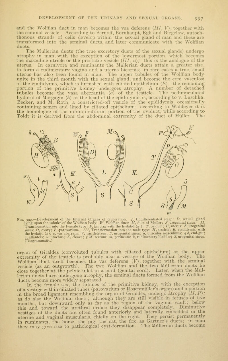 and tlic WoUlian duct in man becomes the vas deferens (///, V), together with the seminal vesicle. According to Sernoff, Bornhaupt, Egli and Bicgelow, autoch- thonous strands of cells develop within the sexual gland of man and these are transformed into the seminal ducts, and later communicate with the Wolfiian ducts. The Miillerian ducts (the true excretory ducts of the sexual glands) undergo atrophy in man, with the exception of the lowermost portion, which becomes the masculine utricle or the prostatic vesicle (///, u); this is the analogue of the uterus. In carnivora and ruminants the Miillerian ducts attain a greater size, to form a rudimentary vagina and a uterus bicornis; in rare cases a true, small uterus has also been found in man. The upper tubules of the Woli'fian body unite in the third month with the sexual gland, and become the coni vasculosi of the epididymis, which is furnished with ciliated epithelium (£); the remaining I)ortion of the primitive kidney undergoes atrophy. A number of detached tubules become the vasa aberrantia (a) of the testicle. The pcdunuculated hydatid of Morgagni Qi) at the head of the epididymis is, according; to v. Luschka, Becker, and M. Roth, a constricted-off vesicle of the epididymis, occasionally containing semen and lined by ciliated epithelium; according to Waldeyer it is the homologue of the infundibuliform portion of the oviduct, while according to Toldt it is derived from the abdominal extremitv of the duct of Miiller. The Fig. 392.—Development of the Internal Organs of Generation. /, Undifferentiated stage: D, se.xual gland lying upon the tubules of the Wolffian body; IF, Wolffian duct; A/, duct of Miiller; 5, urogenital sinus. //, Transformation into the Female type: F, fimbria with the hydatid (/»'); T, oviduct;_ U, uterus; 5, urogenital sinus; O, ovary; P, parovarium. ///, Transformation into the male type: H, testicle; E, epididymis, with the hydatid (/;); a, vas aberrans; V, vas deferens; 5, urogenital sinus; «, utriculus masculinus; 4 </, end-gut; a, allantois; «, urachus; A', cloaca; s Af, rectum; ot, perineum; i, rudimentary bladder; 5, urogenital sinus. (Diagrammatic.) organ of Giraldfes (convoluted tubules with ciliated epithelium) at the upper extreinity of the testicle is probably also a vestige of the Wolffian body. The Wolffian duct itself becomes the vas deferens (I/), together with the seminal vesicle (as an outgrowth). The two Wolffian and the two Miillerian ducts lie close together at the pelvic inlet in a cord (genital cord). Later, when the Miil- lerian ducts have undergone atrophy, the seminal ducts formed from the Wolffian ducts become more widely separated. In the female sex, the tubules of the primitive kidney, with the exception of a vestige within ciliated tubes (parovarium or Rosenmiiller's organ) and a portion in the broad ligament resembling the organ of Giraldes, undergo atrophy {11, P); as do also the Wolffian ducts; although they are still visible in fetuses of five months, but downward only as far as the region of the vaginal vault; below this and toward the urethral orifice they disappear completely. Diminutive vestiges of the ducts are often found anteriorly and laterally embedded in the uterine and vaginal muscularis, chiefly on the right. They persist permanently in ruminants, the horse, the pig, the cat, the fox, as Gartner's ducts; m man they may give rise to pathological cyst-formation. The MuUerian ducts become