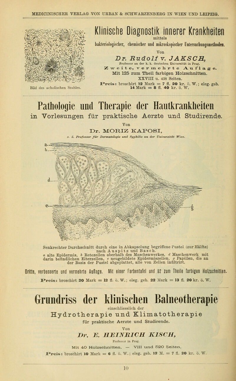 ^^^^mi& -Mi llSIlltiif Bild des acholischen Stuhles. Klinische Diagnostik innerer Krankheiten mittels bakteriologischer, chemischer und mikroskopischer Untersuchungsmethoden. Von Dr. Rudolf v. JAKSCH, Professor an der k, k. deutschen Universität in Prag. Zweite, vermehrte A. u f 1 a g e. Mit 125 zum Theil farbigen Holzschnitten. XXVIII u. 438 Seiten. IPreis: broschirt 12 Mark = 7 fl. 20 kr. ö. W.; eleg. geb. 14 Mark = 8 fl. 40 kr. ö. W. Pathologie und Therapie der Hautkrankheiten in Vorlesungen für praktische Aerzte und Studirende. Von Dr. MORIZ KAPOSI, o. 5. Professor für Dermatologie und Syphilis an der Universität Wien. „r- ??-r^- d- Senkrechter Durchschnitt durch eine in Abkapselung begriffene Pustel (zur Hälfte) nach A u s p i t z und B a s c h. a alte Epidermis, b Retezellen oberhalb des Maschenwerkes, d Maschenwerk mit darin befindlichen Eiterzellen, e neugebildete Epidermiszellen, g Papillen, die an der Basis der Pustel abgeplattet, alle von Zellen inflltrirt. , verbesserte und vermehrte Auflage. Mit einer Farbentafel und 82 zum Theile farbigen Holzschnitten. Preis: broschirt 20 Mark = 12 fl. ö. W.; eleg. geb. 22 Mark = 13 fl. 20 kr. ö. W. Grundriss der klinischen Balneotherapie einschliesslich der Hydrotherapie und Klimatotherapie für praktische Aerzte und Studirende. Von J)r. B. HEINRICH KISCH, Professor in Prag. Mit 40 Holzschnitten. — VIII und 520 Seiten. .Preis: broschirt 10 Mark = 6 fl. ö. W.; eleg. geb. 12 M. = 7 fl. 20 kr. ö. W.