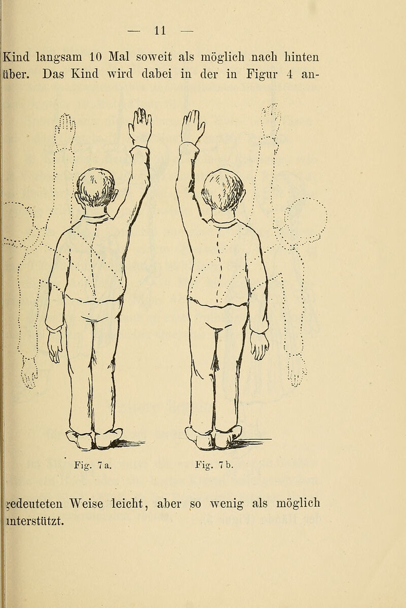 Kind langsam 10 Mal soweit als möglich nach hinten über. Das Kind wird dabei in der in Figur 4 an- Fis;. 7 a. Fiü:. 7 b. ',-edeuteten Weise leicht, aber so wenig als möglich intersttitzt.