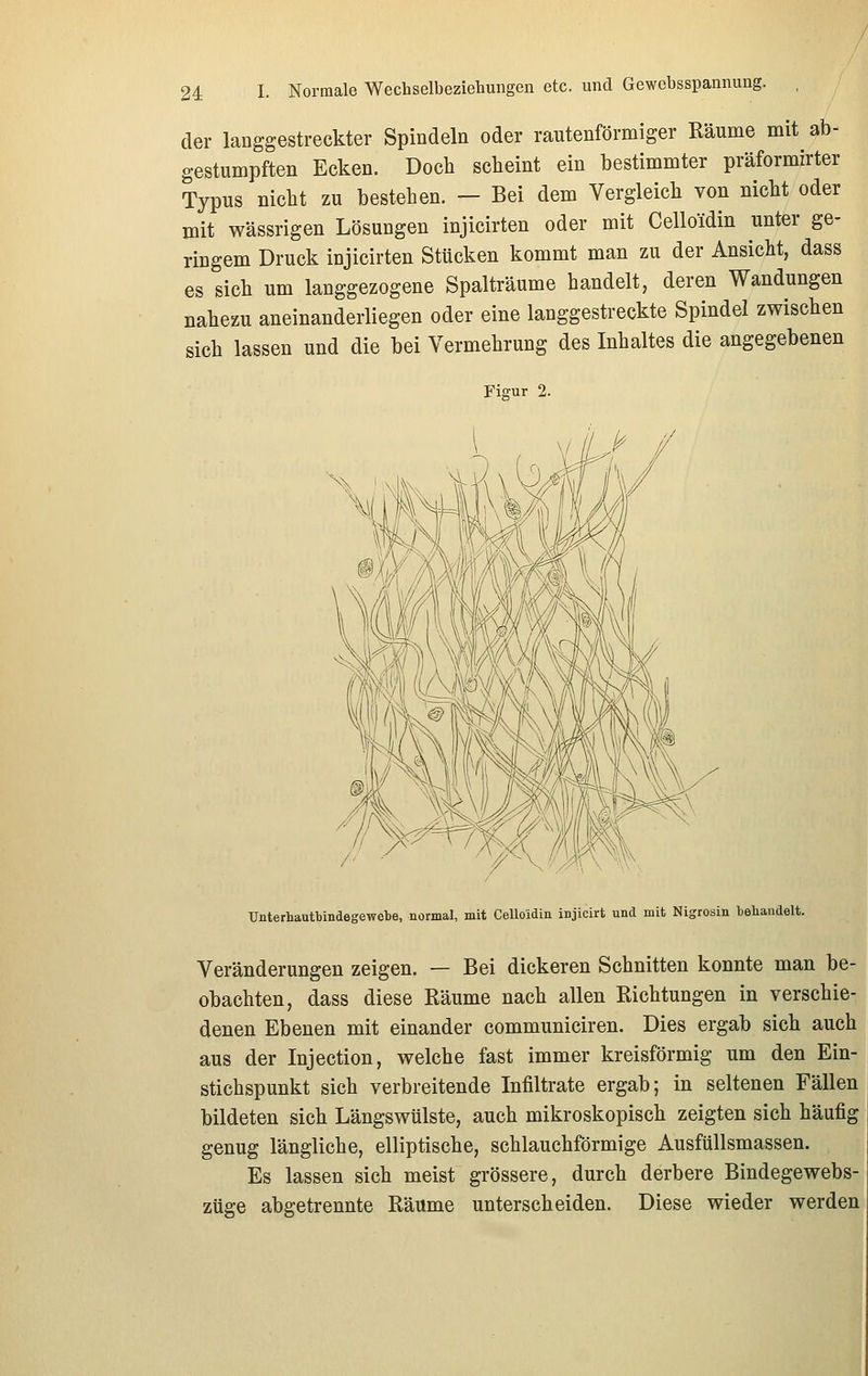 der langgestreckter Spindeln oder rautenförmiger Räume mit ab- gestumpften Ecken. Doch scheint ein bestimmter präformirter Typus nicht zu bestehen. — Bei dem Vergleich von nicht oder mit wässrigen Lösungen injicirten oder mit Celloidin unter ge- ringem Druck injicirten Stücken kommt man zu der Ansicht, dass es sich um langgezogene Spalträume handelt, deren Wandungen nahezu aneinanderliegen oder eine langgestreckte Spindel zwischen sich lassen und die bei Vermehrung des Inhaltes die angegebenen Figur 2. Unterhautbindegewebe, normal, mit Celloidin injicirt und mit Nigrosin behandelt. Veränderungen zeigen. — Bei dickeren Schnitten konnte man be- obachten, dass diese Räume nach allen Richtungen in verschie- denen Ebenen mit einander communiciren. Dies ergab sich auch aus der Injection, welche fast immer kreisförmig um den Ein- stichspunkt sich verbreitende Infiltrate ergab; in seltenen Fällen bildeten sich Längswülste, auch mikroskopisch zeigten sich häufig genug längliche, elliptische, schlauchförmige Ausfüllsmassen. Es lassen sich meist grössere, durch derbere Bindegewebs- züge abgetrennte Räume unterscheiden. Diese wieder werden