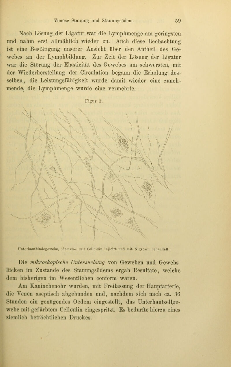 Nach Lösung der Ligatur war die Lymphmenge am geringsten und nahm erst allmählich wieder zu. Auch diese Beobachtung ist eine Bestätigung unserer Ansicht über den Antheil des Ge- webes an der Lymphbildung. Zur Zeit der Lösung der Ligatur war die Störung der Elasticität des Gewebes am schwersten, mit der Wiederherstellung der Circulation begann die Erholung des- selben, die Leistungsfähigkeit wurde damit wieder eine zuneh- mende, die Lymphmenge wurde eine vermehrte. Fi<?ur 3. Unterhautbindcffewebe, ödoinatös, mit Celloidin iiijicirt und mit Nigrosiii lieliandelt. Die wikroskofische, Untersuchimf) von Geweben und Gewebs- lücken im Zustande des Stauungsödems ergab Resultate, welche dem bisherigen im Wesentlichen conform waren. Am Kaninchenohr wurden, mit Freilassung der Hauptarterie, die Venen aseptisch abgebunden und, nachdem sich nach ca. 36 Stunden ein genügendes Oedem eingestellt, das Unterhautzellge- webe mit gefärbtem Celloidin eingespritzt. Es bedurfte hierzu eines ziemlich beträchtlichen Druckes. I