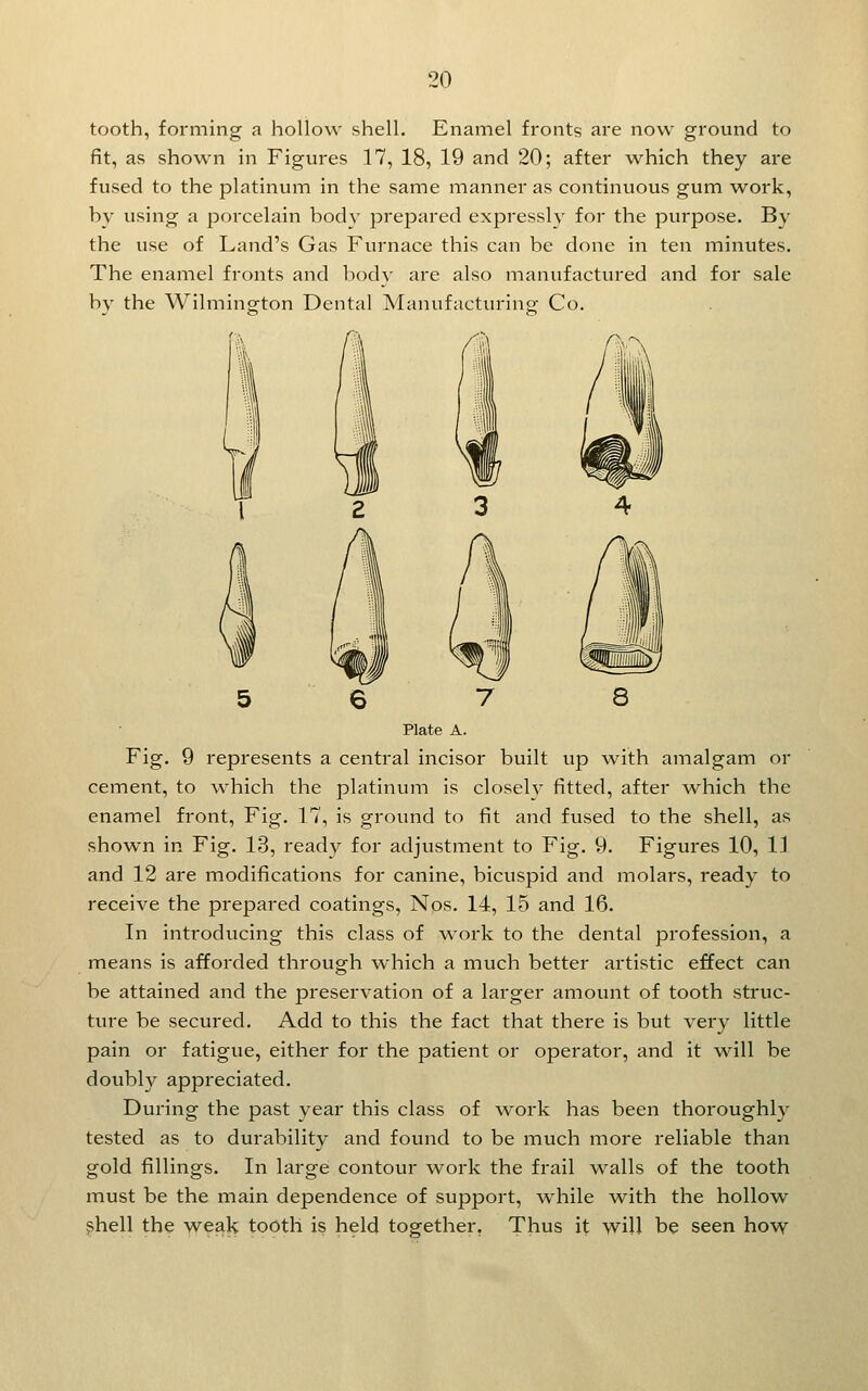 tooth, foiming a hollow shell. Enamel fronts are now ground to fit, as shown in Figures 17, 18, 19 and 20; after which they are fused to the platinum in the same manner as continuous gum work, by using a porcelain body prepared expressly for the purpose. By the use of Land's Gas Furnace this can be done in ten minutes. The enamel fronts and body are also manufactured and for sale by the Wilmington Dental Manufacturing Co. 5 6 7 8 Plate A. Fig. 9 represents a central incisor built up w^ith amalgam or cement, to which the platinum is closely fitted, after which the enamel front, Fig. 17, is ground to fit and fused to the shell, as shown in Fig. 13, ready for adjustment to Fig. 9. Figures 10, IJ and 12 are modifications for canine, bicuspid and molars, ready to receive the prepared coatings, Nos. 14, 15 and 16. In introducing this class of work to the dental profession, a means is afforded through which a much better artistic effect can be attained and the preservation of a larger amount of tooth struc- ture be secured. Add to this the fact that there is but very little pain or fatigue, either for the patient or operator, and it will be doubly appreciated. During the past year this class of work has been thoroughh'- tested as to durability and found to be much more reliable than gold fillings. In large contour work the frail walls of the tooth must be the main dependence of support, while with the hollow ?hell the weak tooth is held together. Thus it will be seen hovv^