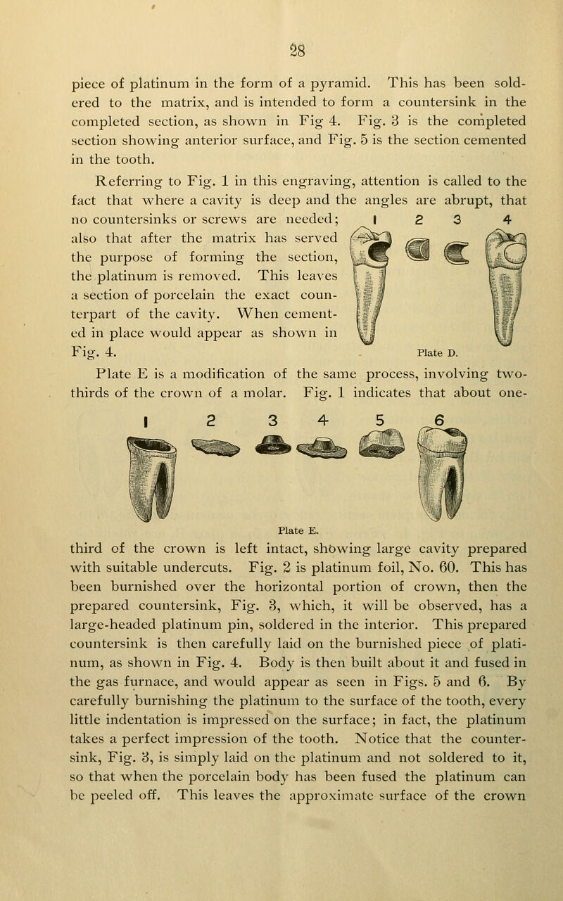 S8 piece of platinum in the form of a pyramid. This has been sold- ered to the matrix, and is intended to form a countersink in the completed section, as shown in Fig 4. Fig. 3 is the cornpleted section showing anterior surface, and Fig. 5 is the section cemented in the tooth. Referring to Fig. 1 in this engraving, attention is called to the fact that where a cavity is deep and the angles are abrupt, that no countersinks or screws are needed; also that after the matrix has served the purpose of forming the section, the platinum is removed. This leaves a section of porcelain the exact coun- terpart of the cavity. When cement- ed in place would appear as shown in Fig. 4. Plate E is a modification of the same process, involving two- thirds of the crown of a molar. Figf. 1 indicates that about one- Plate D. Plate E. third of the crown is left intact, showing large cavity prepared with suitable undercuts. Fig. 2 is platinum foil. No. 60. This has been burnished over the horizontal portion of crown, then the prepared countersink, Fig. 3, which, it will be observed, has a large-headed platinum pin, soldered in the interior. This prepared countersink is then carefully laid on the burnished piece of plati- num, as shown in Fig. 4. Body is then built about it and fused in the gas furnace, and would appear as seen in Figs. 5 and 6. By carefully burnishing the platinum to the surface of the tooth, every little indentation is impressed on the surface; in fact, the platinum takes a perfect impression of the tooth. Notice that the counter- sink, Fig. 3, is simply laid on the platinum and not soldered to it, so that when the porcelain body has been fused the platinum can be peeled off. This leaves the approximate surface of the crown