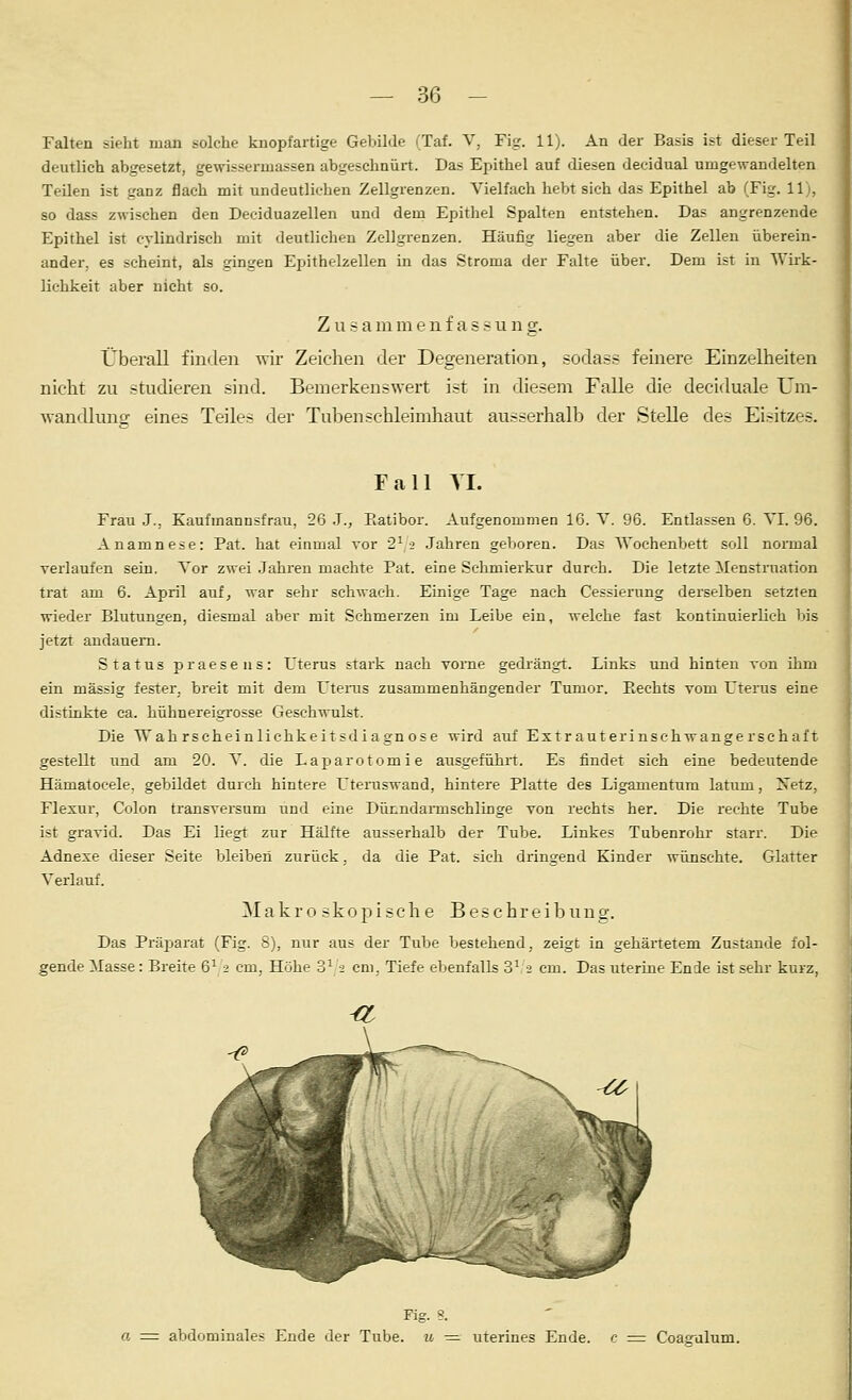 Falten sieht man solche knopfartige Gebilde (Taf. V, Fig. 11). An der Basis ist dieser Teil deutlich abgesetzt, gewissermassen abgeschnürt. Das Epithel auf diesen decidual umgewandelten Teilen ist ganz flach mit undeutlichen Zellgrenzen. Vielfach hebt sich das Epithel ab (Fig. 11), so dass zwischen den Deciduazellen und dem Epithel Spalten entstehen. Das angrenzende Epithel ist cylindrisch mit deutlichen Zellgrenzen. Häufig liegen aber die Zellen überein- ander, es scheint, als gingen Epithelzellen in das Stroma der Falte über. Dem ist in Wirk- liehkeit aber nicht so. Z u s a in m e n f a s .s u n g. Überall findeti wir Zeichen der Degeneration, sodass feinere Einzelheiten nicht zu studieren sind. Bemerkenswert ist in diesem Falle die deciduale Um- wandlun^ eines Teiles der Tuben Schleimhaut ausserhalb der Stelle des Eisitzes. Fall YI. Frau J.. Kaufinannsfrau, 26 J., Eatibor. Aufgenommen 16. Y. 96. Entlassen 6. YI. 96. Anamnese: Pat. hat einmal vor 2^2 Jahren geboren. Das Wochenbett soll normal verlaufen sein. Yor zwei .Jahi'en machte Pat. eine Schmierkur durch. Die letzte Menstruation trat am 6. April auf, war sehr schwach. Einige Tage nach Cessierung derselben setzten wieder Blutungen, diesmal aber mit Schmerzen im Leibe ein, welche fast kontinuierlich bis jetzt andauern. Status praesens: L'terus stark nach vorne gedi'ängt. Links und hinten von ihm ein massig fester, breit mit dem Uterus zusammenhängender Tumor. Bechts yom Uterus eine distinkte ca. hühnereigrosse Geschwulst. Die Wahrscheinlichkeitsdiagnose wird auf Extraut erinschwange rschaft gestellt nnd am 20. Y. die Laparotomie ausgefühit. Es findet sich eine bedeutende Hämatocele, gebildet durch hintere Etemswand, hintere Platte des Ligamentum latum, Xetz, Flexur, Colon transversum und eine Dünndarmschlinge von rechts her. Die rechte Tube ist gravid. Das Ei liegt zur Hälfte ausserhalb der Tube. Linkes Tubenrohr starr. Die Adnexe dieser Seite bleiben zurück, da die Pat. sieh dringend Kinder wünschte. Glatter Yerlauf. 31 a k r 0 s k 0 p i s c h e B e s c h r e i h u n g. Das Präparat (Fig. S), nur aus der Tube bestehend, zeigt in gehärtetem Zustande fol- gende Masse: Breite 6^ 2 cm, Höhe 3^ 2 cm, Tiefe ebenfalls 3^ 2 cm. Das uterine Ende ist sehr kurz, Fig. 8. abdominales Ende der Tube, u =1 uterines Ende, c = Coag'alum.