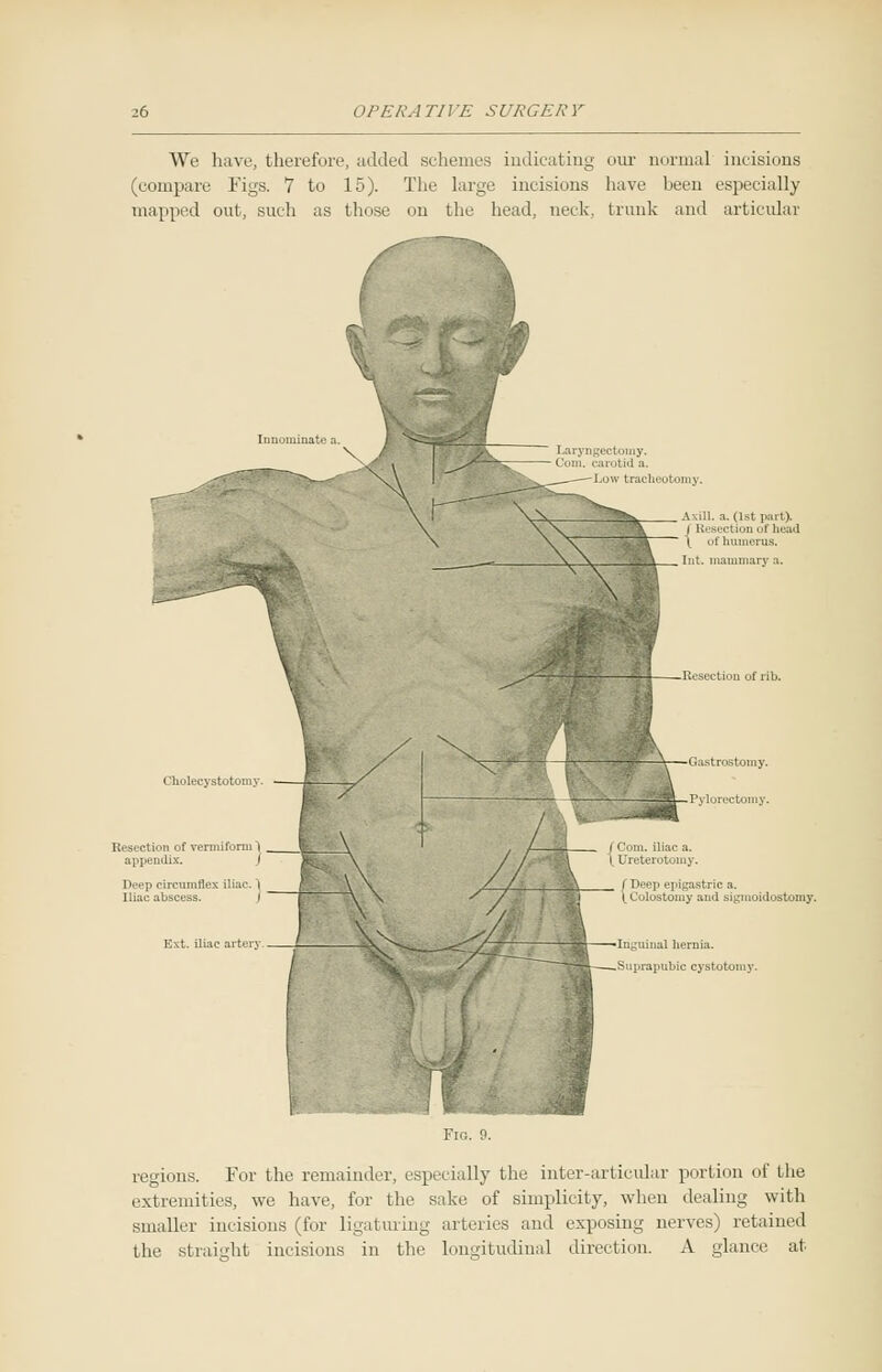 We have, therefore, added schemes indicating our normal incisions (compare Figs. 7 to 15). The large incisions have been especially mapped out, such as those on the head, neck, trunk and articular Resection of vermiform 1 _ appendix. I Deep circumflex iliac, 1 J Iliac abscess. Ext. iliac arter Axill. a. (1st part). Resection of head of humerus. —-Resection of rib. f Deep epigastric a. \_ Colostomy and sigmoidostomy. regions. For the remainder, especially the inter-articular portion of the extremities, we have, for the sake, of simplicity, when dealing with smaller incisions (for ligaturing arteries and exposing nerves) retained the straight incisions in the longitudinal direction. A glance at