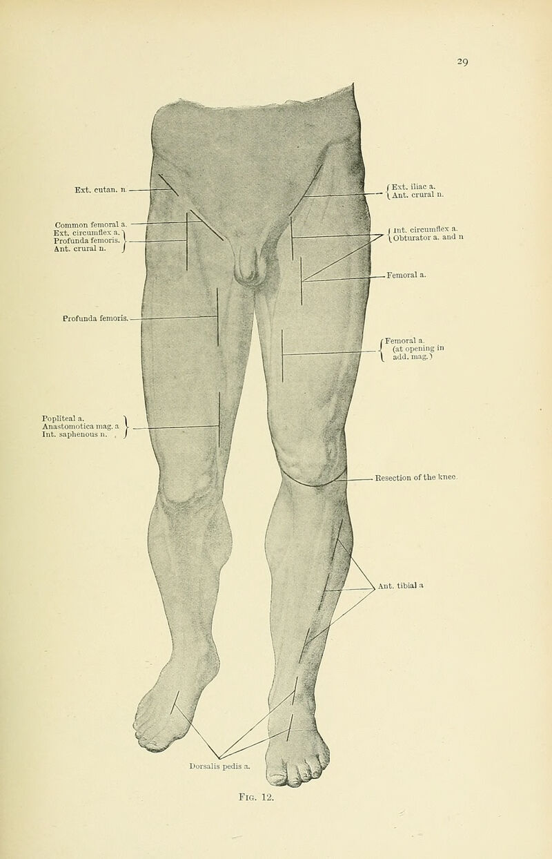 Common femoral Ext. circumflex a Profunda femoris Ant. crural Profunda femoris, iliteal a. ^ istomotica mag. a V , saphenous n. , J