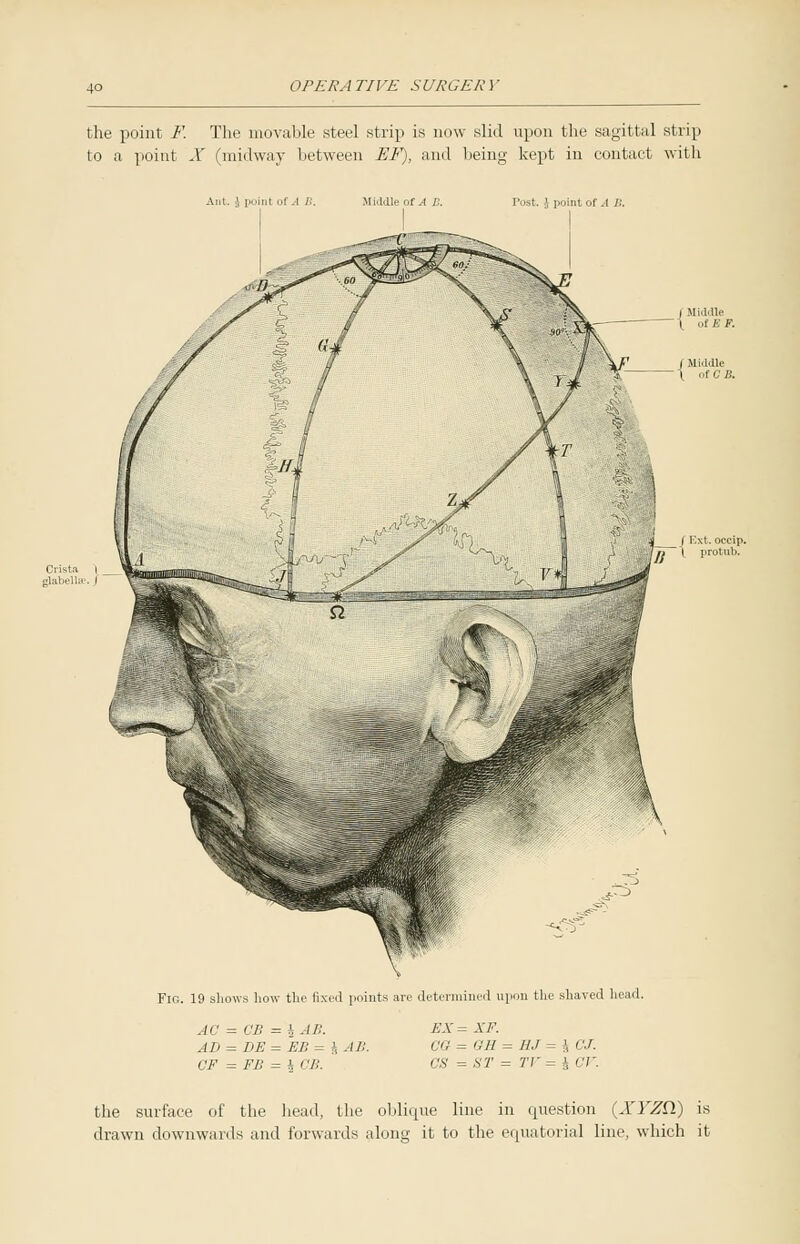 the point F. The movable steel strip is now slid upon the sagittal strip to a point X (midway between EF), and being kept in contact with Ant. S point of A I:. Middle of A B. Tost. J point of A IS. Fig. 19 shows how the fixed points are determined upon the shaved head. 1 AC = VI', = \ .IP. All = HE = EB = :\ AS. CF = FB = h <■/;. EX = XF. CG = GM = 11J = I CJ. OS = ST = TV= J CV. the surface of the head, the oblique line in question (XYZQ.) is drawn downwards and forwards along it to the equatorial line, which it