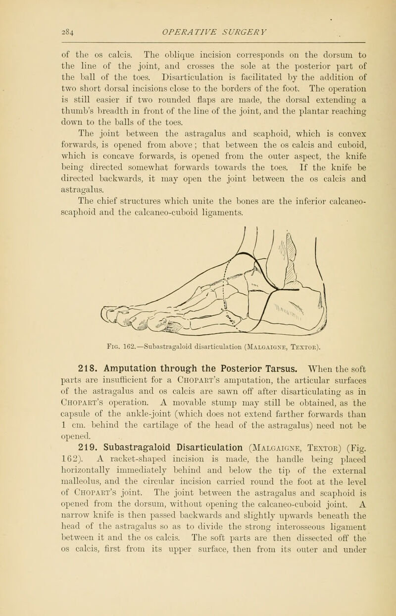 of the os calcis. The oblique incision corresponds on the dorsum to the line of the joint, and crosses the sole at the posterior part of the ball of the toes. Disarticulation is facilitated by the addition of two short dorsal incisions close to the borders of the foot. The operation is still easier if two rounded flaps are made, the dorsal extending a thumb's breadth in front of the line of the joint, and the plantar reaching down to the balls of the toes. The joint between the astragalus and scaphoid, which is convex forwards, is opened from above; that between the os calcis and cuboid, which is concave forwards, is opened from the outer aspect, the knife being directed somewhat forwards towards the toes. If the knife be directed backwards, it may open the joint between the os calcis and astragalus. The chief structures which unite the bones are the inferior calcaneo- scaphoid and the calcaneo-cuboid ligaments. Fig. 162.—Subastragaloid disarticulation (Malgaigxe, Textor). 218. Amputation through the Posterior Tarsus. AVhen the soft parts are insufficient for a Chopart's amputation, the articular surfaces of the astragalus and os calcis are sawn off after disarticulating as in Chopart's operation. A movable stump may still be obtained, as the capsule of the ankle-joint (which does not extend farther forwards than 1 cm. behind the cartilage of the head of the astragalus) need not be opened. 219. Subastrag-aloid Disarticulation (Malgaigne, Textoe) (Fig. 162). A racket-shaped incision is made, the handle being placed horizontally immediately behind and below the tip of the external malleolus, and the circular incision carried round the foot at the level of Chopart's joint. The joint between the astragalus and scaphoid is opened from the dorsum, without opening the calcaneo-cuboid joint. A narrow knife is then passed backwards and slightly upwards beneath the head of the astragalus so as to divide the strong interosseous ligament between it and the os calcis. The soft parts are then dissected off the os calcis, first from its upper surface, then from its outer and under