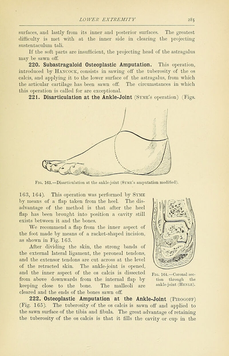 surfaces, and lastly from its inner and posterior surfaces. The greatest difficulty is met with at the inner side in clearing the projecting sustentaculum tali. If the soft parts are insufficient, the projecting head of the astragalus may be sawn off. 220. Subastragaloid Osteoplastic Amputation. This operation, introduced by Hancock, consists in sawing off the tuberosity of the os calcis, and applying it to the lower surface of the astragalus, from which the articular cartilage has been sawn off. The circumstances in which this operation is called for are exceptional. 221. Disarticulation at the Ankle-Joint (Syme's operation) (Figs. Fig. 163.—Disarticulation at the ankle-joint (Syme's amputation modified). 163, 164). This operation was performed by Syme by means of a flap taken from the heel. The dis- advantage of the method is that after the heel flap has been brought into position a cavity still exists between it and the bones. We recommend a flap from the inner aspect of the foot made by means of a racket-shaped incision, as shown in Fig. 163. After dividing the skin, the strong bands of the external lateral ligament, the peroneal tendons, and the extensor tendons are cut across at the level of the retracted skin. The ankle-joint is opened, and the inner aspect of the os calcis is dissected from above downwards from the internal flap by keeping close to the bone. The malleoli are cleared and the ends of the bones sawn off. 222. Osteoplastic Amputation at the Ankle-Joint (Pieogoff) (Fig. 165). The tuberosity of the os calcis is sawn off and applied to the sawn surface of the tibia and fibula. The great advantage of retaining the tuberosity of the os calcis is that it fills the cavity or cup in the Fig. 164.—Coronal sec- tion through the ankle-joint (Henle).