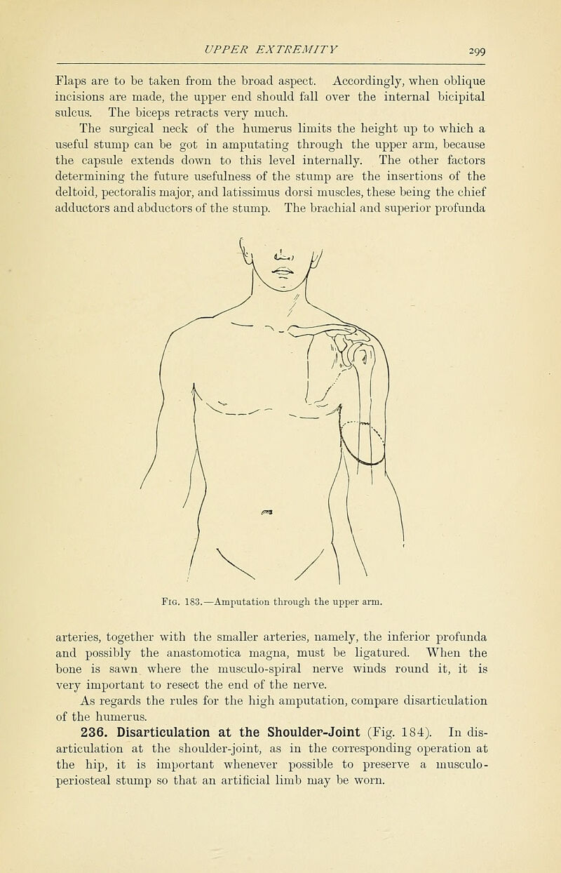 Flaps are to be taken from the broad aspect. Accordingly, when oblique incisions are made, the upper end should fall over the internal bicipital sulcus. The biceps retracts very much. The surgical neck of the humerus limits the height up to which a useful stump can be got in amputating through the upper arm, because the capsule extends down to this level internally. The other factors determining the future usefulness of the stump are the insertions of the deltoid, pectoralis major, and latissimus dorsi muscles, these being the chief adductors and abductors of the stump. The brachial and superior profunda Fis. 183.—Amputation through the upper arm. arteries, together with the smaller arteries, namely, the inferior profunda and possibly the anastomotica magna, must be ligatured. When the bone is sawn where the musculo-spiral nerve winds round it, it is very important to resect the end of the nerve. As regards the rules for the high amputation, compare disarticulation of the humerus. 236. Disarticulation at the Shoulder-Joint (Fig. 184). In dis- articulation at the shoulder-joint, as in the corresponding operation at the hip, it is important whenever possible to preserve a musculo- periosteal stump so that an artificial limb may be worn.