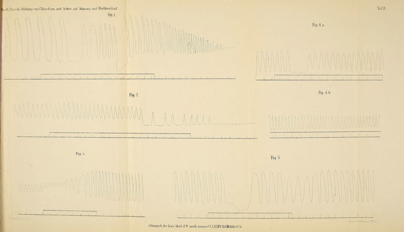 iioll.lVnlit'Wn-faimi von.CMoiofoxm und .Vertier auf Afimmiuj und Blutkreislauf Fig.l. VJ J Ü i L i i i I i l i i J i l__l TafJl Big.4 a w \ \ \ 1 \ I Ml I mmnw J i : I I I Kg, i_J L Rg.4.1>. IUI Pia ■> Es 3. l f\ (1 J L Silzungsl).derkais.Akad.d W. uiatk.natunvCLLXXIV.B4DIAl.tli.lo7d,