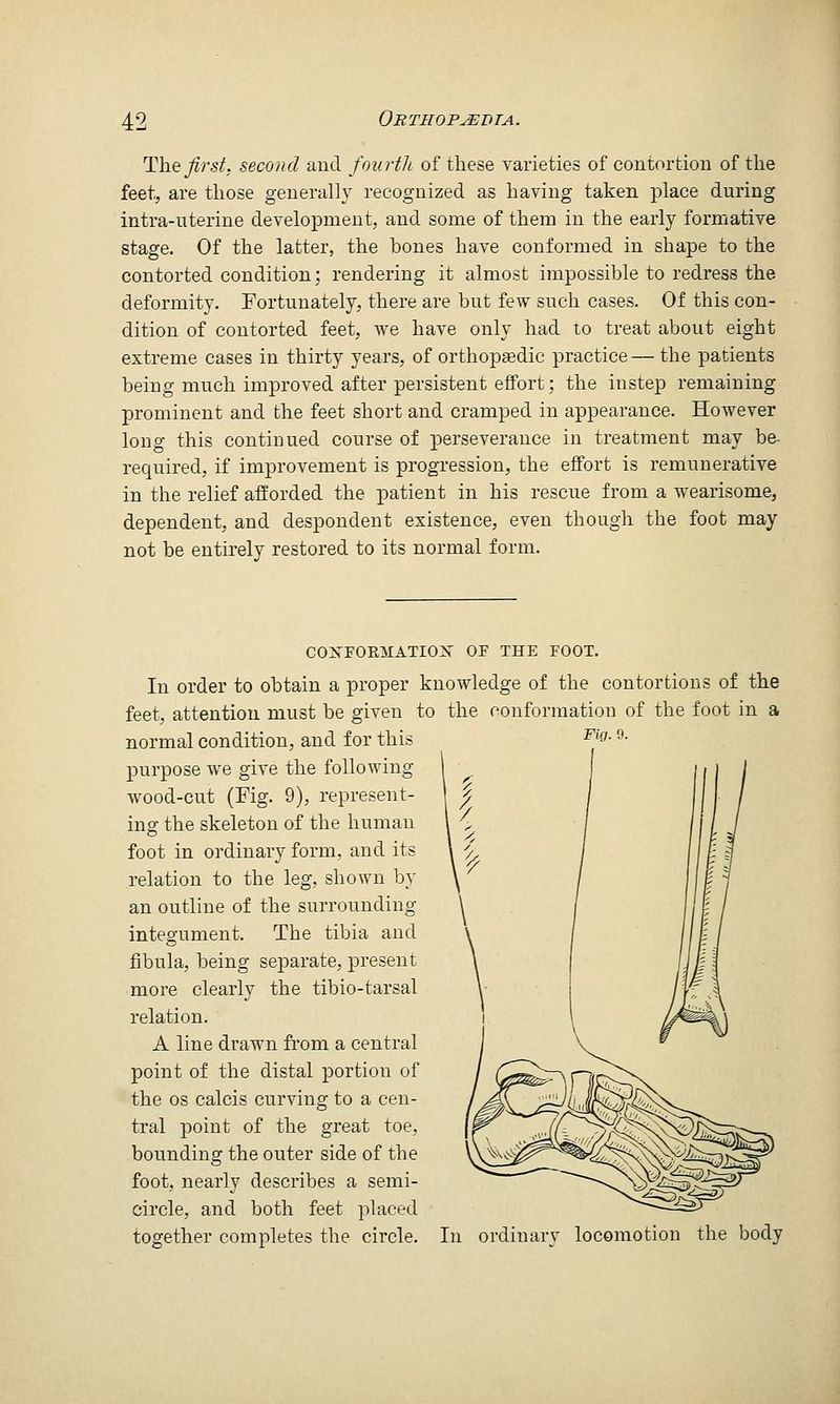 The first, second and fourth of these varieties of contortion of the feet, are those generally recognized as having taken place during intra-uterine development, and some of them in the early formative stage. Of the latter, the bones have conformed in shape to the contorted condition; rendering it almost impossible to redress the deformity. Fortunately, there are but few such cases. Of this con- dition of contorted feet, we have only had to treat about eight extreme cases in thirty years, of orthopaedic practice — the patients being much improved after persistent effort; the instep remaining prominent and the feet short and cramped in appearance. However long this continued course of perseverance in treatment may be. required, if improvement is progression, the effort is remunerative in the relief afforded the patient in his rescue from a wearisome, dependent, and despondent existence, even though the foot may not be entirely restored to its normal form. COXFOKMATIOX OF THE FOOT. In order to obtain a proper knowledge of the contortions of the feet, attention must be given to the conformation of the foot in a normal condition, and for this purpose we give the following wood-cut (Fig. 9), represent- ing the skeleton of the human foot in ordinary form, and its relation to the leg, shown by an outline of the surrounding integument. The tibia and fibula, being separate, present more clearly the tibio-tarsal relation. A line drawn from a central point of the distal portion of the OS calcis curving to a cen- tral point of the great toe, bounding the outer side of the foot, nearly describes a semi- circle, and both feet placed together completes the circle. In ordinarv locomotion the body