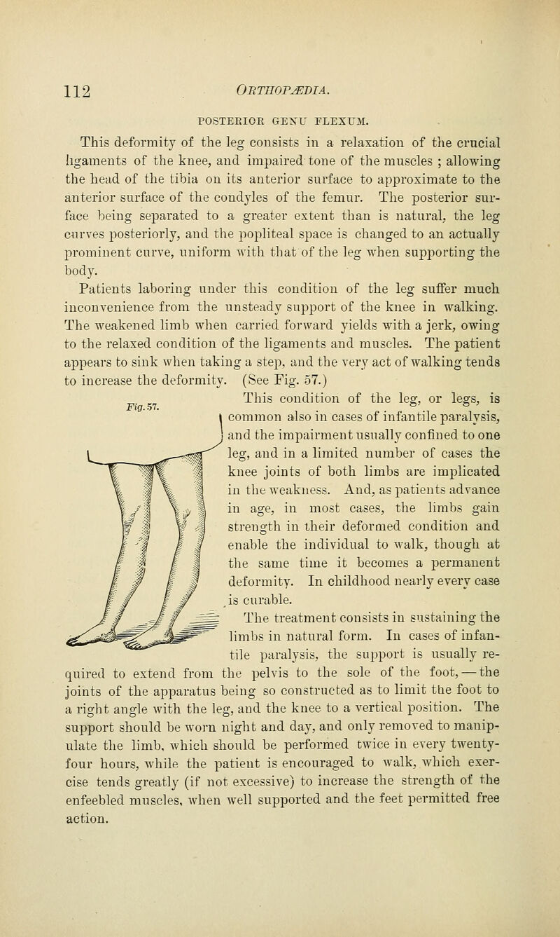 Fig. HI. POSTERIOR GEXU FLEXUM. This deformity of the leg consists in a relaxatiou of the crucial ligaments of the knee, and impaired tone of the muscles ; allowing the head of the tibia on its anterior surface to approximate to the anterior surface of the condyles of the femur. The posterior sur- face being separated to a greater extent than is natural, the leg curves posteriorly, and the popliteal space is changed to an actually prominent curve, uniform with that of the leg when supporting the body. Patients laboring under this condition of the leg suffer much inconvenience from the unsteady support of the knee in walking. The weakened limb when carried forward yields with a jerk, owing to the relaxed condition of the ligameuts and muscles. The patient appears to sink when taking a step, and the very act of walking tends to increase the deformity. (See Fig. 57.) This condition of the leg, or legs, is common also in cases of infantile paralysis, and the impairment usually confined to one leg, and in a limited number of cases the knee joints of both limbs are implicated in the weakness. And, as patients advance in age, in most cases, the limbs gain strength in their deformed condition and enable the individual to walk, though at the same time it becomes a permanent deformity. In childhood neaily every case ,is curable. The treatment consists in sustaining the limbs in natural form. In cases of infan- tile paralysis, the support is usually re- quired to extend from the pelvis to the sole of the foot, — the joints of the apparatus being so constructed as to limit the foot to a right angle with the leg, and the knee to a vertical position. The support should be worn night and day, and only removed to manip- ulate the limb, Avhich should be performed twice in every twenty- four hours, while the patient is encouraged to walk, which exer- cise tends greatly (if not excessive) to increase the strength of the enfeebled muscles, Avhen well supported and the feet permitted free action.