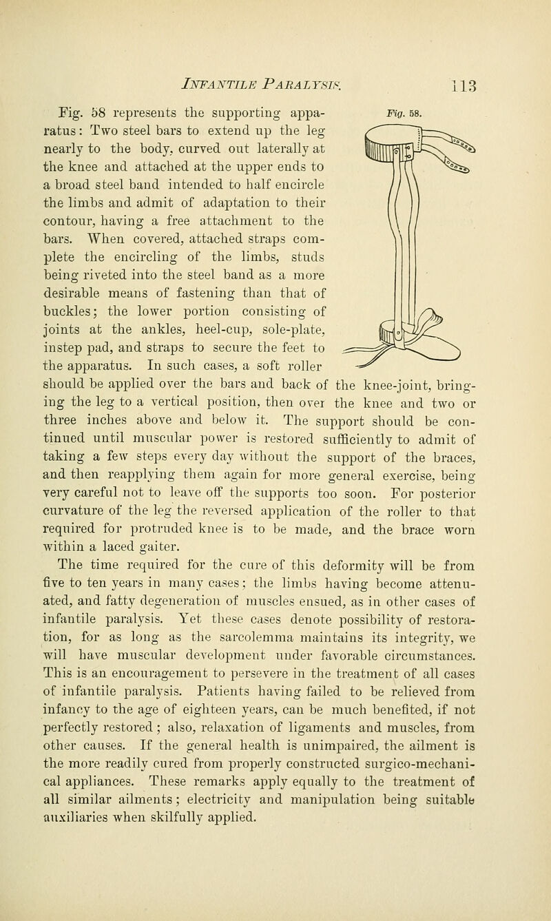 Fig. 58 represents the supporting appa- mg. bs. ratus: Two steel bars to extend up tlie leg nearly to the body, curved out laterally at the knee and attached at the upper ends to a broad steel band intended to half encircle the limbs and admit of adaptation to their contour, having a free attachment to the bars. When covered, attached straps com- plete the encircling of the limbs, studs being riveted into the steel band as a more desirable means of fastening than that of buckles; the lower portion consisting of joints at the ankles, heel-cup, sole-plate, instep pad, and straps to secure the feet to the apparatus. In such cases, a soft roller should be applied over the bars and back of the knee-joint, bring- ing the leg to a vertical position, then over the knee and two or three inches above and below it. The support should be con- tinued until muscular power is restored sufficiently to admit of taking a few steps every day without the support of the braces, and then reapplying them again for more general exercise, being very careful not to leave off the supports too soon. For posterior curvature of the leg the reversed application of the roller to that required for protruded knee is to be made, and the brace worn within a laced gaiter. The time required for the cure of this deformity will be from five to ten years in many cases; the limbs having become attenu- ated, and fatty degeneration of muscles ensued, as in other cases of infantile paralysis. Yet these cases denote possibility of restora- tion, for as long as the sarcolemma maintains its integrity, we will have muscular development under favorable circumstances. This is an encouragement to persevere in the treatment of all cases of infantile paralysis. Patients having failed to be relieved from infancy to the age of eighteen years, can be much benefited, if not perfectly restored; also, relaxation of ligaments and muscles, from other causes. If the general health is unimpaired, the ailment is the more readily cured from properly constructed surgico-mechani- cal appliances. These remarks apply equally to the treatment of all similar ailments; electricity and manipulation being suitable auxiliaries when skilfully applied.