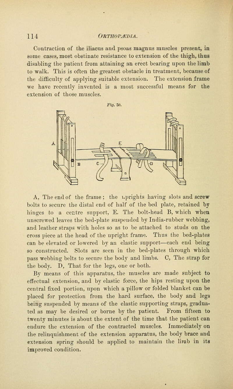 Contraction of the iliacus and psoas magnus muscles present, in some cases, most obstinate resistance to extension of the thigh, thus disabling the patient from attaining an erect bearing upon the limb to walk. This is often the greatest obstacle in treatment, because of the difficulty of applying suitable extension. The extension frame we have recently invented is a most successful means for the extension of those muscles. Fifif. 59. A, The end of the frame ; the i^prights having slots and screw bolts to secure the distal end of half of the bed plate, retained by hinges to a centre support, E. The bolt-head B, which when unscrewed leaves the bed-plate suspended by India-rubber webbing, and leather straps with holes so as to be attached to studs on the cross piece at the head of the upright frame. Thus the bed-plates can be elevated or lowered by an elastic support—each end being so constructed. Slots are seen in the bed-plates through which pass webbing belts to secure the body and limbs. C, The strap for the body. D, That for the legs, one or both. By means of this apparatus, the muscles are made subject to effectual extension, and by elastic force, the hips resting upon the central fixed portion, upon which a pillow or folded blanket can be placed for protection from the hard surface, the body and legs being suspended by means of the elastic supporting straps, gradua- ted as may be desired or borne by the patient. From fifteen to twenty minutes is about the extent of the time that the patient can endure the extension of the contracted muscles. Immediately on the relinquishment of the extension apparatus, the body brace and extension spring should be applied to maintain the limb in its improved condition.