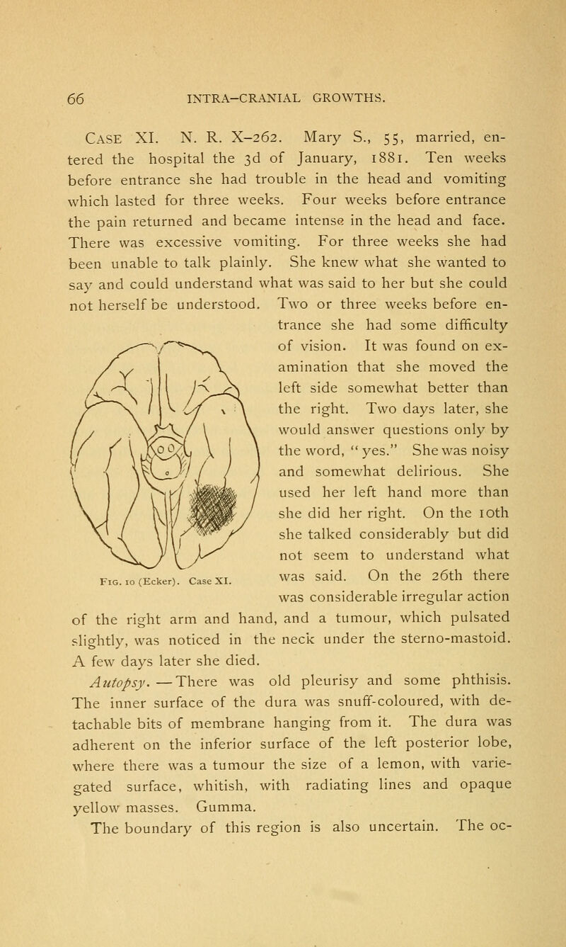 Case XI. N. R. X-262. Mary S., 55, married, en- tered the hospital the 3d of January, 1881. Ten weeks before entrance she had trouble in the head and vomiting which lasted for three weeks. Four weeks before entrance the pain returned and became intense in the head and face. There was excessive vomiting. For three weeks she had been unable to talk plainly. She knew what she wanted to say and could understand what was said to her but she could not herself be understood. Two or three weeks before en- trance she had some difficulty of vision. It was found on ex- amination that she moved the left side somewhat better than the right. Two days later, she would answer questions only by the word,  yes. She was noisy and somewhat delirious. She used her left hand more than she did her right. On the 10th she talked considerably but did not seem to understand what was said. On the 26th there was considerable irregular action of the right arm and hand, and a tumour, which pulsated slightly, was noticed in the neck under the sterno-mastoid. A few days later she died. Autopsy. —There was old pleurisy and some phthisis. The inner surface of the dura was snuff-coloured, with de- tachable bits of membrane hanging from it. The dura was adherent on the inferior surface of the left posterior lobe, where there was a tumour the size of a lemon, with varie- gated surface, whitish, with radiating lines and opaque yellow masses. Gumma. The boundary of this region is also uncertain. The oc-