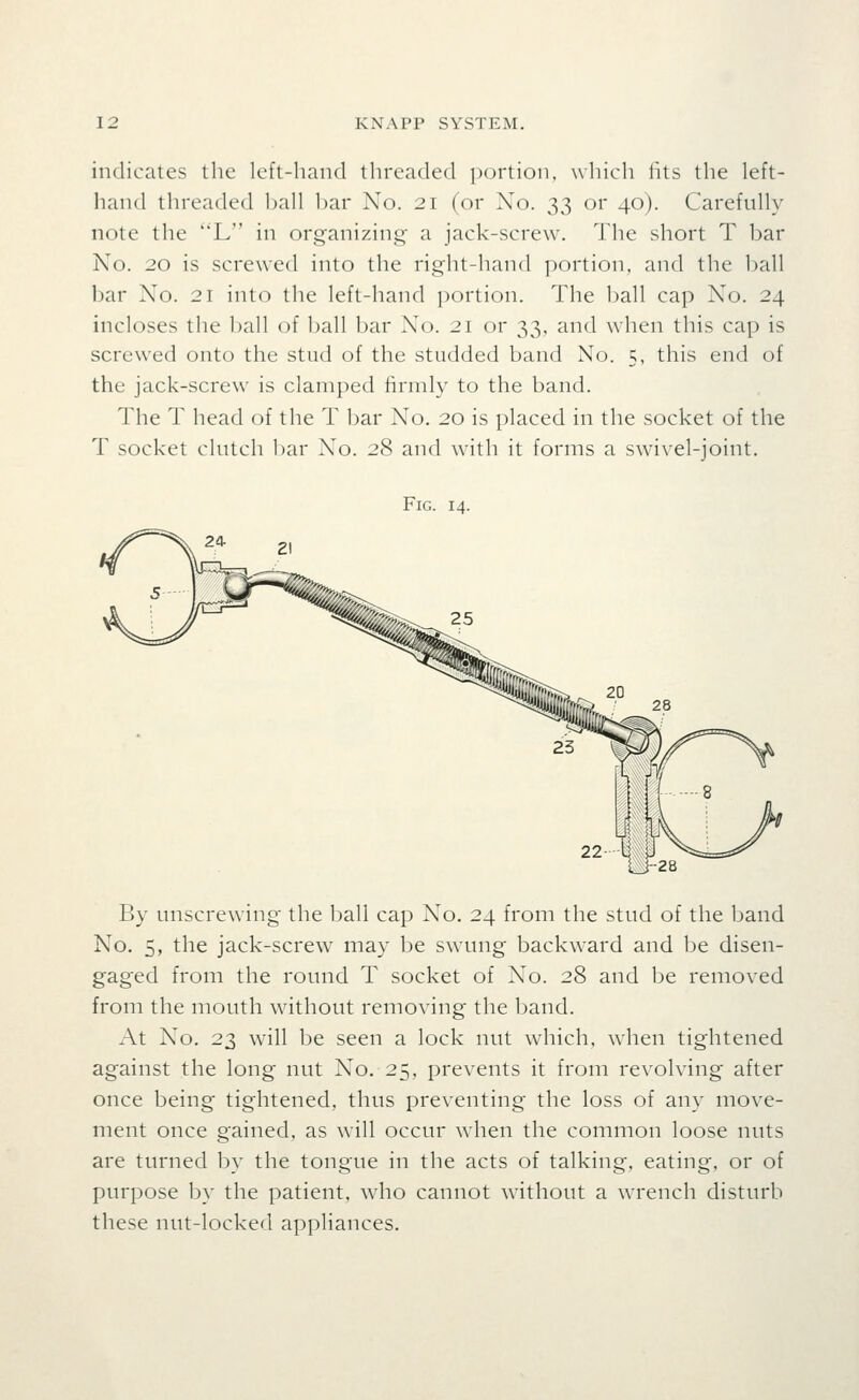 indicates the left-hand threaded portion, which lits the left- hand threaded l)all bar No. 21 (or No. 33 or 40). Carefully note the L in organizing- a jack-screw. The short T bar No. 20 is screwed into the right-hand portion, and the ball bar No. 21 into the left-hand portion. The ball cap No. 24 incloses the ball of ball bar No. 21 or 33, and when this cap is screwed onto the stud of the studded band No. 5, this end of the jack-screw is clamped firmly to the band. The T head of the T bar No. 20 is placed in the socket of the T socket clutch bar No. 28 and with it forms a swivel-joint. Fig. 14. U 28 By unscrewing the ball cap No. 24 from the stud of the band No. 5, the jack-screw may be swung backward and be disen- gaged from the round T socket of No. 28 and be removed from the mouth wdthout removing the band. At No. 23 will be seen a lock nut which, when tightened against the long nut No. 25, prevents it from revolving after once being tightened, thus preventing the loss of any move- ment once gained, as will occur when the common loose nuts are turned by the tongue in the acts of talking, eating, or of purpose by the patient, who cannot without a wrench disturb these nut-locked appliances.