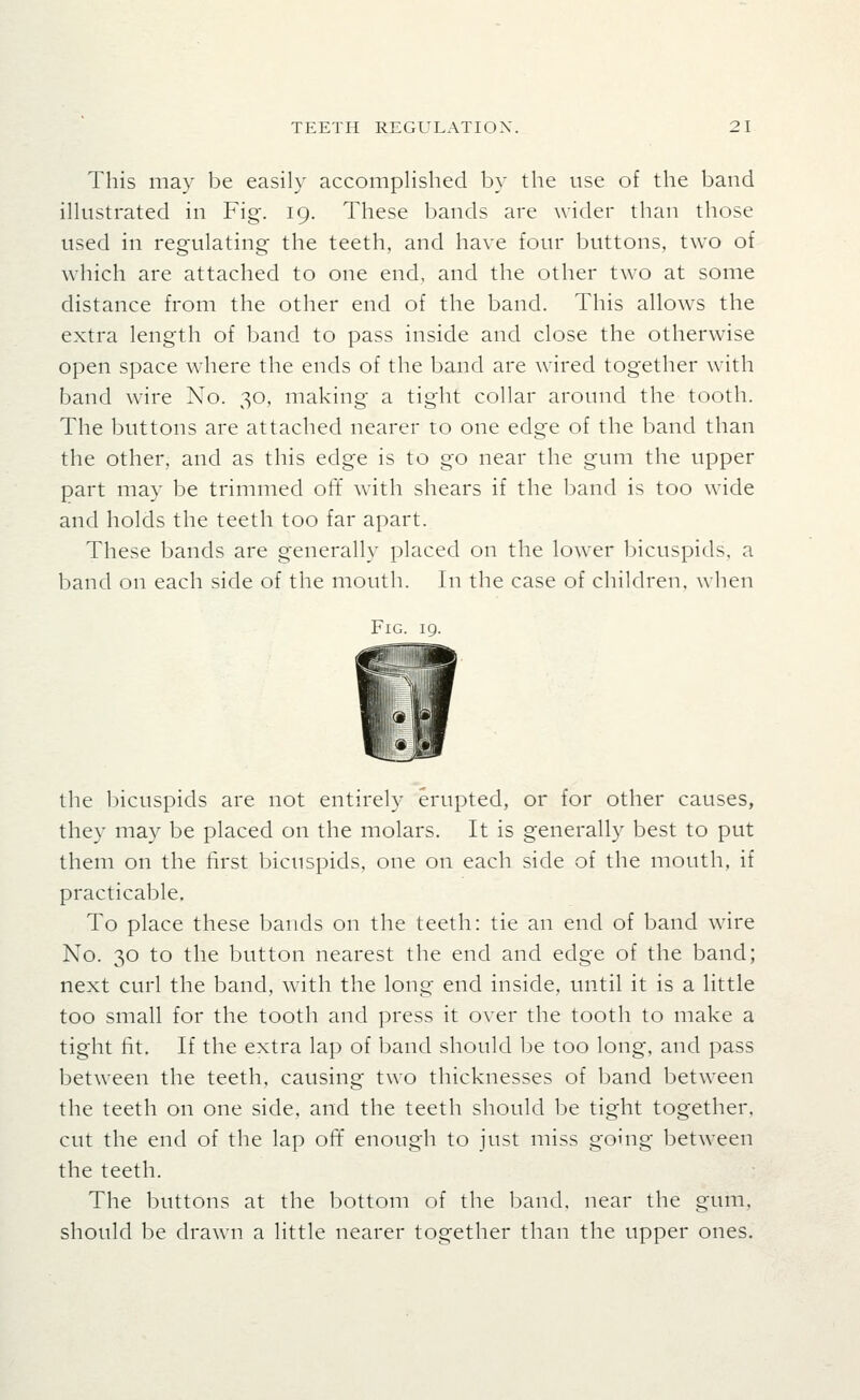 This may be easily accomplished by the use of the band illustrated in Fig. 19. These bands are wider than those used in regulating the teeth, and have four buttons, two of which are attached to one end, and the other two at some distance from the other end of the band. This allows the extra length of band to pass inside and close the otherwise open space where the ends of the l:>and are wired together with band wire No. 30, making a tight collar around the tooth. The buttons are attached nearer to one edge of the band than the other, and as this edge is to go near the gum the upper part may be trimmed off with shears if the band is too wide and holds the teeth too far apart. These bands are generally placed on the lower bicuspids, a band on each side of the mouth. In the case of children, when Fig. 19. the bicuspids are not entirely erupted, or for other causes, they may be placed on the molars. It is generally best to put them on the first bicuspids, one on each side of the mouth, if practicable. To place these bands on the teeth: tie an end of band wire No. 30 to the button nearest the end and edge of the band; next curl the band, with the long end inside, until it is a little too small for the tooth and press it over the tooth to make a tight fit. If the extra lap of band should be too long, and pass between the teeth, causing two thicknesses of band between the teeth on one side, and the teeth should be tight together, cut the end of the lap off enough to just miss going between the teeth. The buttons at the bottom of the band, near the gum, should be drawn a little nearer together than the upper ones.