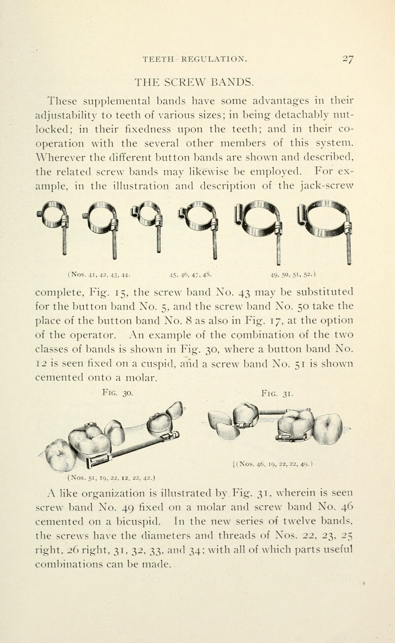 THE SCREW BANDS. These supplemental bands have some advantages in their adjustability to teeth of various sizes; in being detachably nut- locked; in their fixedness upon the teeth; and in their co- operation with the several other members of this system. Wherever the different button bands are shown and described, the related screw bands may likewise be employed. For ex- ample, in the illustration and description of the jack-screw (Nos. 41, 42, 43,44. 45. 46, 47, 4S. 49. 50, 51. 52.) complete, Fig. 15, the screw band No. 43 may be substituted for the button band No. 5, and the screw band No. 50 take the place of the button band No. 8 as also in Fig. 17, at the option of the operator. An example of the combination of the two classes of bands is shown in Fig. 30, where a button band No. 12 is seen fixed on a cuspid, and a screw band No. 51 is shown cemented onto a molar. Fig. 30. Fig. 31. [(Nos. 46, 19, 22, 22, 49.) (Nos. 51, 19, 22, 12, 22, 42.) A like organization is illustrated by Fig. 31, wherein is seen screw band No. 49 fixed on a molar and screw band No. 46 cemented on a bicuspid. In the new series of twelve bands, the screws have the diameters and threads of Nos. 22, 23. 25 right, 26 right, 31, 32, 33, and 34; with all of which parts useful coml)inations can l)e made.