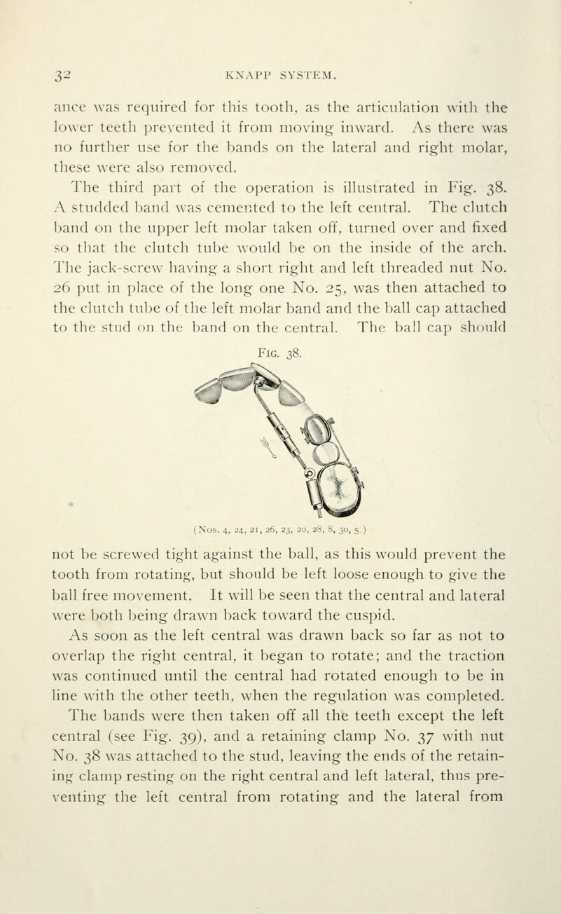 ance was required for this tooth, as the articulation with the lower teeth prevented it from moving inward. As there was no further use for the bands on the lateral and right molar, these were also removed. The third part of the operation is illustrated in Fig. 38. A studded l)and was cemented to the left central. The clutch band on the upper left molar taken off, turned over and fixed so that the clutch tube would be on the inside of the arch. The jack-screw having a short right and left threaded nut No. 26 put in place of the long one No. 25, was then attached to the clutch tube of the left molar band and the ball cap attached to the stud on the band on the central. The ball cap should Fig. 38. (Nos. 4, 24, 21, 26, 23, 2::>, 2S, .S, 30, 5,) not be screwed tight against the ball, as this would prevent the tooth from rotating, but should be left loose enough to give the ball free movement. It will be seen that the central and lateral were both being drawn back toward the cuspid. As soon as the left central was drawn back so far as not to overlap the right central, it began to rotate; and the traction was continued until the central had rotated enough to be in line with the other teeth, when the regulation was completed. The bands were then taken ofif all the teeth except the left central (see Fig. 39), and a retaining clamp No. 37 with nut No. 38 was attached to the stud, leaving the ends of the retain- ing clamp resting on the right central and left lateral, thus pre- venting the left central from rotating and the lateral from