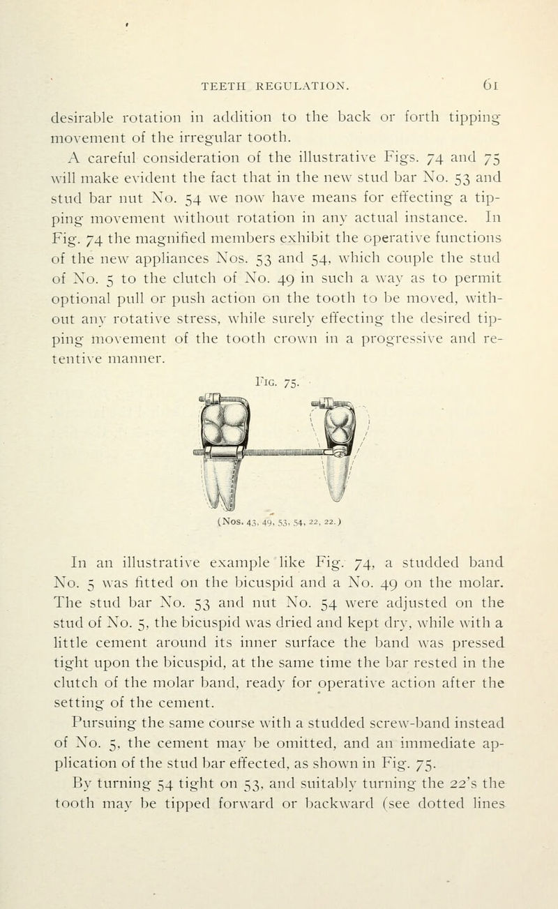 desirable rotation in addition to the back or forth tipping- movement of the irregular tooth. A careful consideration of the illustrative Figs. 74 and 75 will make evident the fact that in the new stud bar No. 53 and stud bar nut No. 54 we now have means for effecting a tip- ping movement without rotation in any actual instance. In Fig. 74 the magnified members exhibit the operative functions of the new appliances Nos. 53 and 54, which couple the stud of Xo. 5 to the clutch of No. 49 in such a way as to permit optional pull or push action on the tooth to be moved, with- out anv rotative stress, while surely effecting the desired tip- ping mo\ement of the tc^oth crown in a progressive and re- tentive manner. Fig. 75. (Nos. 43, 49. 53. 54. 22, 22.) In an illustrative example like Fig. 74, a studded band No. 5 was fitted on the bicuspid and a No. 49 on the molar. The stud bar No. 53 and nut No. 54 were adjusted on the stud of No. 5, the bicuspid was dried and kept dry, while with a little cement around its inner surface the band was pressed tight upon the bicuspid, at the same time the bar rested in the clutch of the molar band, ready for operative action after the setting of the cement. Pursuing the same course with a studded screw-band instead of No. 5, the cement may be omitted, and an immediate ap- plication of the stud bar effected, as shown in Fig. 75. By turning 54 tight on 53, and suitably turning the 22's the tooth may be tipped forward or Ijackward (see dotted lines