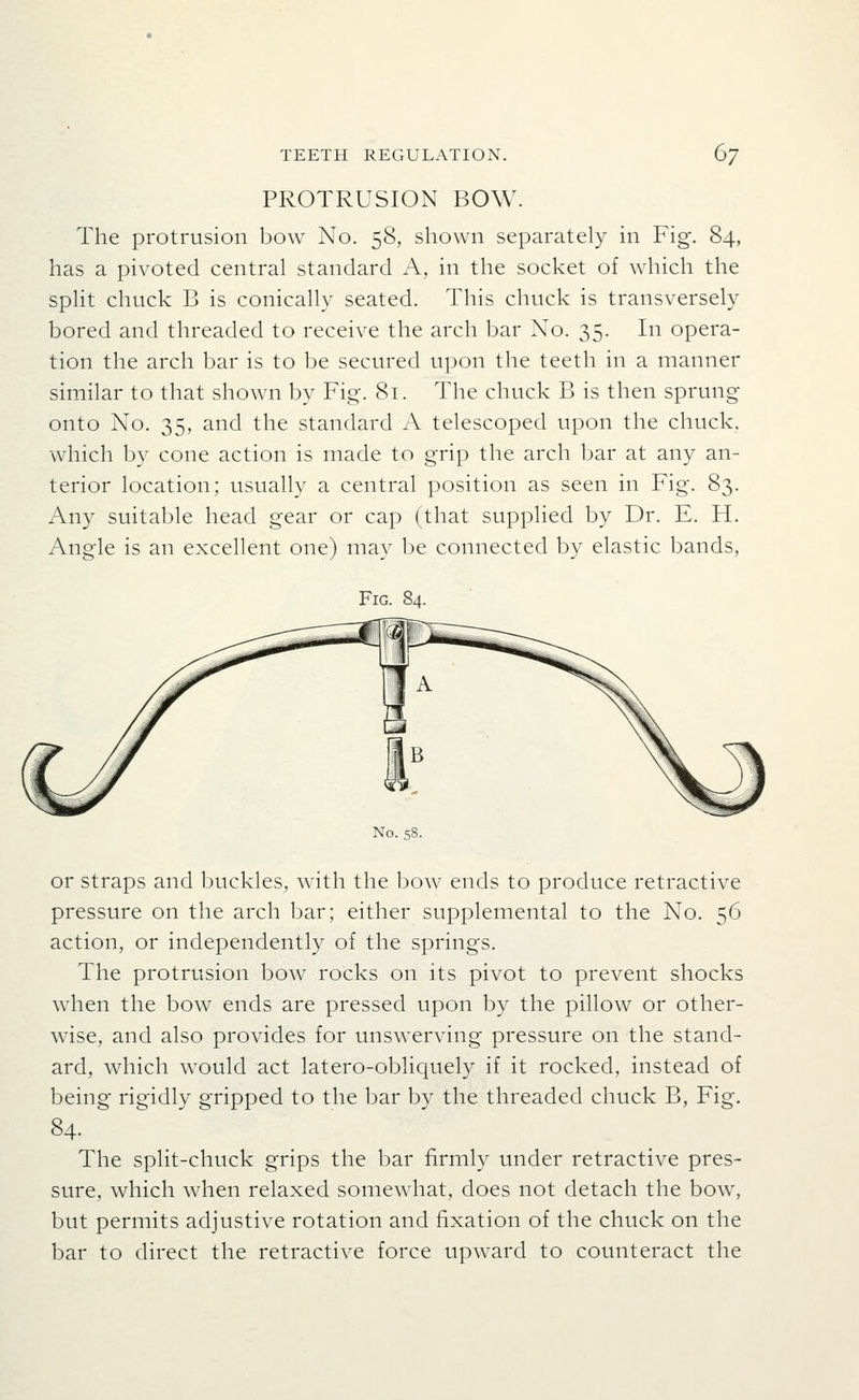 PROTRUSION BOW. The protrusion bow No. 58, shown separately in Fig. 84, has a pivoted central standard A, in the socket of which the split chuck B is conically seated. This chuck is transversely bored and threaded to receive the arch bar No. 35. In opera- tion the arch bar is to be secured upon the teeth in a manner similar to that shown by Fig. 81. The chuck B is then sprung onto No. 35, and the standard A telescoped upon the chuck, which by cone action is made to grip the arch bar at any an- terior location; usually a central position as seen in Fig. 83. Any suitable head gear or cap (that supplied by Dr. E. H. Angle is an excellent one) may be connected by elastic bands, Fig. 84. No. 58. or straps and buckles, with the bow ends to produce retractive pressure on the arch bar; either supplemental to the No. 56 action, or independently of the springs. The protrusion bow rocks on its pivot to prevent shocks when the bow ends are pressed upon by the pillow or other- wise, and also provides for unswerving pressure on the stand- ard, which would act latero-obliquely if it rocked, instead of being rigidly gripped to the bar by the threaded chuck B, Fig. 84. The split-chuck grips the bar firmly under retractive pres- sure, which when relaxed somewhat, does not detach the bow, but permits adjustive rotation and fixation of the chuck on the bar to direct the retractive force upward to counteract the