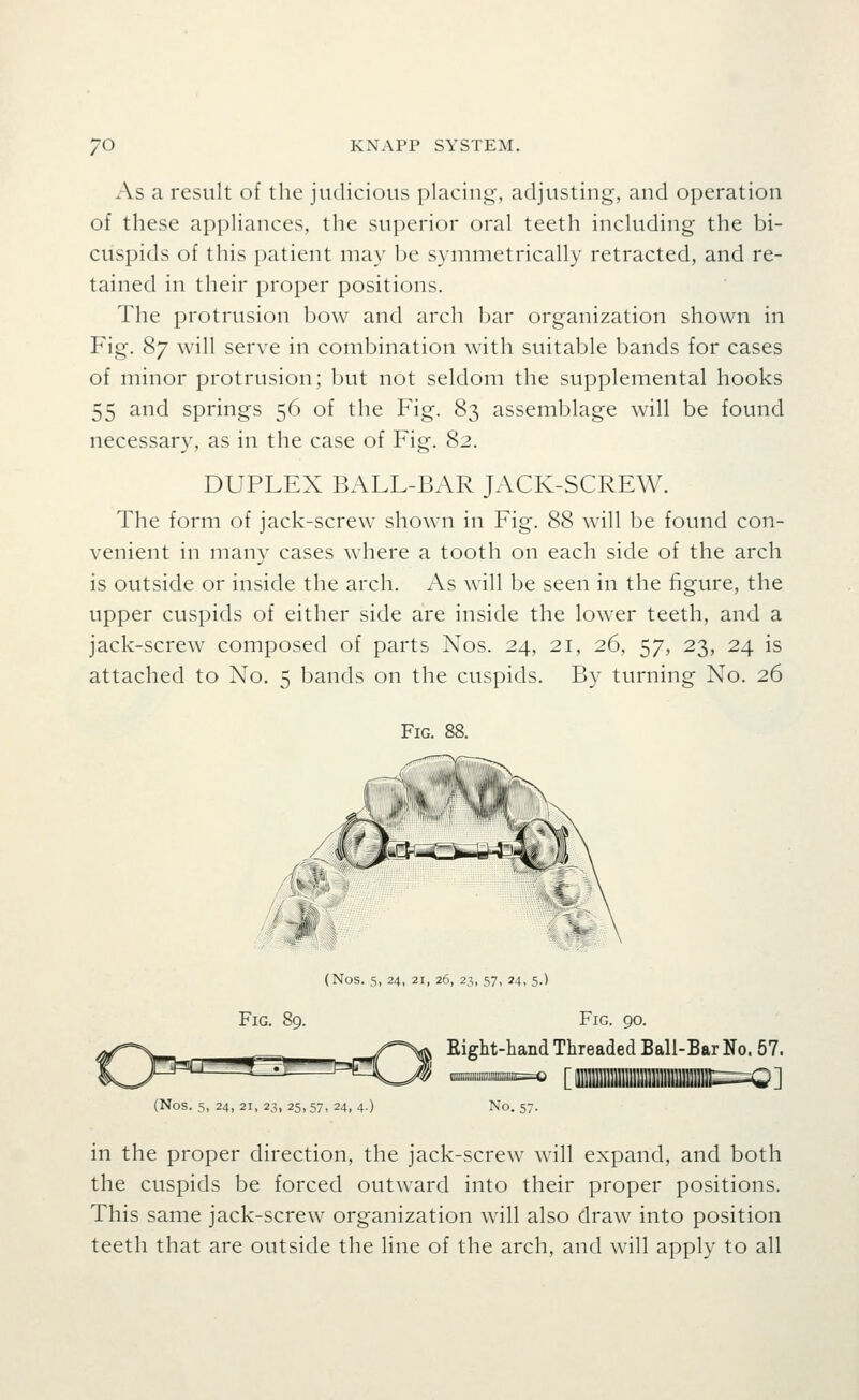 As a result of the judicious placing, adjusting, and operation of these appHances, the superior oral teeth including the bi- cuspids of this patient may be symmetrically retracted, and re- tained in their proper positions. The protrusion bow and arch bar organization shown in Fig. 87 will serve in combination with suitable bands for cases of minor protrusion; but not seldom the supplemental hooks 55 and springs 56 of the Fig. 83 assemblage will be found necessary, as in the case of Fig. 82. DUPLEX BALL-BAR JACK-SCREW. The form of jack-screw shown in Fig. 88 will be found con- venient in many cases where a tooth on each side of the arch is outside or inside the arch. As will be seen in the figure, the upper cuspids of either side are inside the lower teeth, and a jack-screw composed of parts Nos. 24, 21, 26, 57, 23, 24 is attached to No. 5 bands on the cuspids. By turning No. 26 Fig. 88. (Nos. 5, 24, 21, 26, 23, 57, 74, 5.) Fig. 90. Eight-hand Threaded Ball-Bar No. 57. (Nos. 5, 24, 21, 23, 25,57, 24, 4-) No. 57. in the proper direction, the jack-screw will expand, and both the cuspids be forced outward into their proper positions. This same jack-screw organization will also draw into position teeth that are outside the line of the arch, and will apply to all