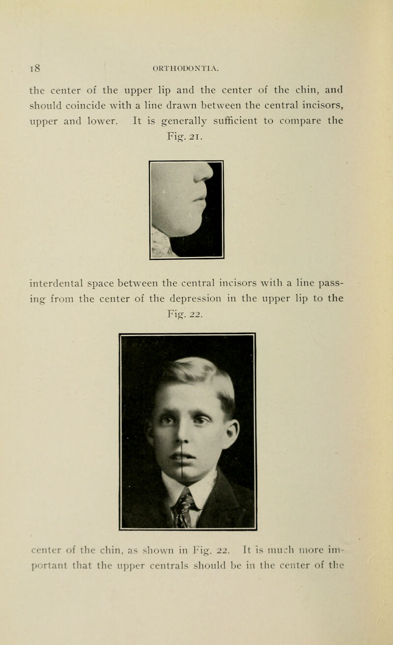 the center of the upper lip and the center of the chin, and should coincide with a line drawn between the central incisors, upper and lower. It is generally sufficient to compare the Fie. 21. interdental space between the central incisors with a line pass- ing from the center of the depression in the upper lip to the Fier. 22. center of tin- chin, as shown in Fig. 22. It is much more- im portant that the upper centrals should be in the center of the