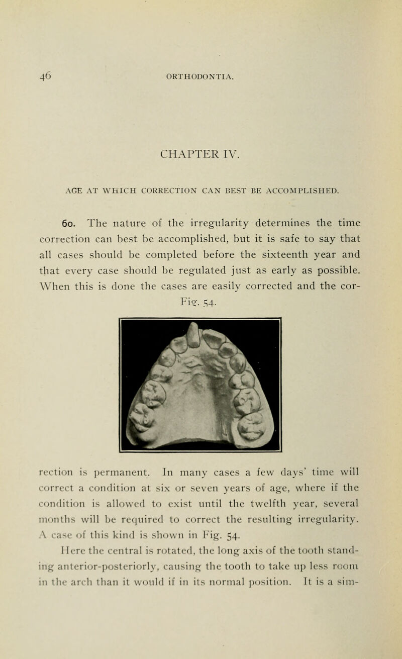 CHAPTER IV ACE AT WHICH CORRECTION CAN 15EST BE ACCOMPLISHED. 60. The nature of the irregularity determines the time correction can best be accomplished, but it is safe to say that all cases should be completed before the sixteenth year and that every case should be regulated just as early as possible. When this is done the cases are easily corrected and the cor- Fis:. 54. rection is permanent. In main- cases a few days' time will correct a condition at six or seven years of age, where if the condition is allowed to exist until the twelfth year, several months will be required to correct the resulting irregularity. \ case of this kind i> shown in Fig. 54. 1 [ere the central is rotated, the long axis of the tooth stand- ing anterior-posteriorly, causing the tooth to take up less room in the arch than it would if in its normal position. It is a sim-