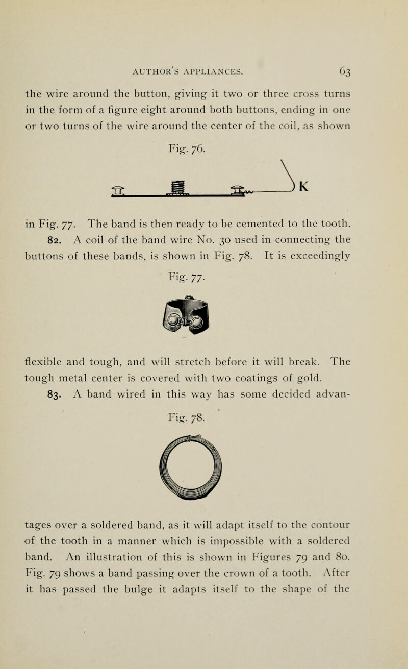 the wire around the button, giving it two or three cross turns in the form of a figure eight around both buttons, ending in one or two turns of the wire around the center of the coil, as shown Fig. 76. in Fig. 77. The band is then ready to be cemented to the tooth. 82. A coil of the band wire No. 30 used in connecting the buttons of these bands, is shown in Fig. 78. It is exceedingly Fig. 77. flexible and tough, and will stretch before it will break. The tough metal center is covered with two coatings of gold. 83. A band wired in this way has some decided advan- Fig. 78. tages over a soldered band, as it will adapt itself to the contour of the tooth in a manner which is impossible with a soldered band. An illustration of this is shown in Figures 79 and 80. Fig. 79 shows a band passing over the crown of a tooth. After it has passed the bulge it adapts itself to the shape of the