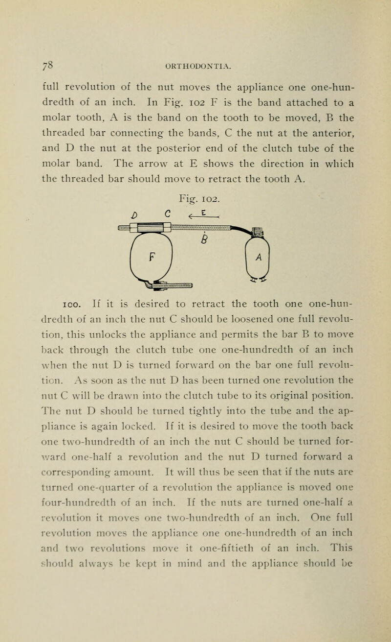 full revolution of the nut moves the appliance one one-hun- dredth of an inch. In Fig. 102 F is the band attached to a molar tooth, A is the band on the tooth to be moved, B the threaded bar connecting the bands. C the nut at the anterior, and D the nut at the posterior end of the clutch tube of the molar band. The arrow at E shows the direction in which the threaded bar should move to retract the tooth A. Figf. 102. ico. If it is desired to retract the tooth one one-hun- dredth of an inch the nut C should be loosened one full revolu- tion, this unlocks the appliance and permits the bar B to move back through the clutch tube one one-hundredth of an inch when the nut D is turned forward on the bar one full revolu- tion. As soon as the nut D has been turned one revolution the nut C will be drawn into the clutch tube to its original position. The nut 13 should be turned tightly into the tube and the ap- pliance is again locked. If it is desired to move the tooth back one two-hundredth of an inch the nut C should be turned for- ward <>ne-half a revolution and the nut D turned forward a corresponding amount. It will thus be seen that if the nuts are turned one-quarter of a revolution tin- appliance is moved one four-hundredth of an inch. If tin- nuts are turned one-half a revolution it moves one two-hundredth of an inch. One full revolution moves the appliance one one-hundredth of an inch and two revolutions move it one-fiftieth of an inch. This should always be kept in mind and the appliance should be