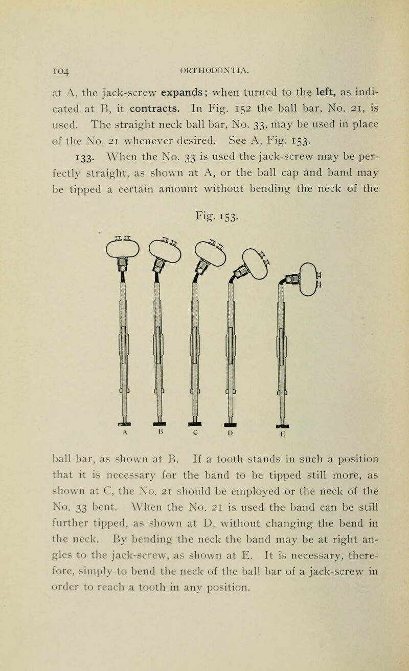 [04 0RTH0D0N1IA. at A. the fack-screw expands; when turned to the left, as indi- cated at B, it contracts. In Fig. 152 the hall bar, No. 21, is used. The straight neck ball bar, No. 33, may be used in place of the Xo. 21 whenever desired. See A, Fig. 153. 133- When the No. 33 is used the jack-screw may be per- fectly straight, as shown at A, or the ball cap and band may be tipped a certain amount without bending the neck of the Fig- 153- ball bar, as shown at B. If a tooth stands in such a position that it is necessary for the band to be tipped still more, as shown at C, the No. 21 should be employed or the neck of the N°- 33 bent. When the No. 21 is used the band can be still further tipped, as shown at I), without changing the bend in the neck. By bending the neck- the band may be at right an- gles to the jack-screw, as shown at E. It is necessary, there- Fore, simpl) to bend the neck of the ball bar of a jack-screw in order to reach a tooth in any position.