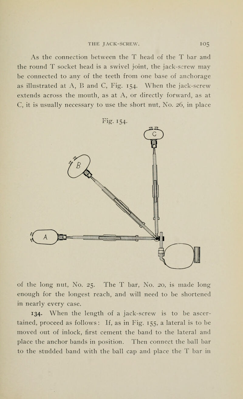 As the connection between the T head of the T bar and the round T socket head is a swivel joint, the jack-screw may be connected to any of the teeth from one base of anchorage as illustrated at A, B and C, Fig. 154. When the jack-screw extends across the mouth, as at A, or directly forward, as at C, it is usually necessary to use the short nut, No. 26, in place Fig. 154- of the long nut, No. 25. The T bar, No. 20, is made long- enough for the longest reach, and will need to be shortened in nearly every case. 134. When the length of a jack-screw is to be ascer- tained, proceed as follows: If, as in Fig. 155, a lateral is to be moved out of inlock, first cement the band to the lateral ami place the anchor bands in position. Then connect the ball bar to the studded band with the ball cap and place the T bar in