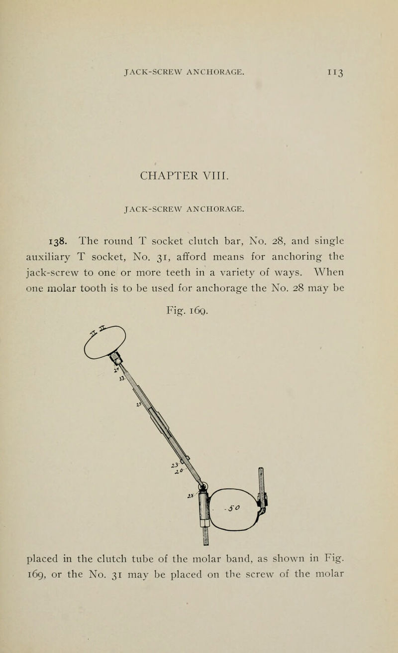 CHAPTER VIIT. JACK-SCREW ANCHORAGE. 138. The round T socket clutch bar, No. 28, and single auxiliary T socket, No. 31, afford means for anchoring the jack-screw to one or more teeth in a variety of ways. When one molar tooth is to be used for anchorage the No. 28 may be Fig. i6q. placed in the clutch tube of the molar band, as shown in Fig. 169, or the No. 31 may be placed on the screw of the molar