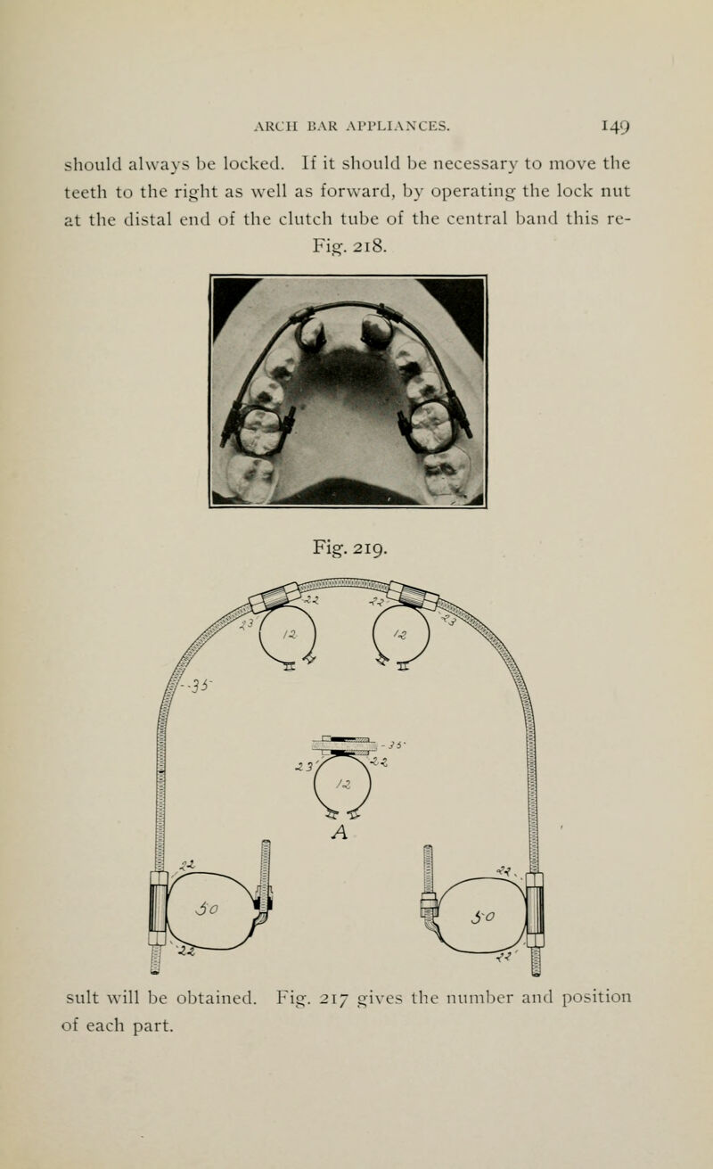 should always be locked. If it should be necessary to move the teeth to the right as well as forward, by operating the lock nut at the distal end of the clutch tube of the central band this re- Fig. 218. Fig. 219. suit will be obtained. Fig. 217 gives the number and position of each part.