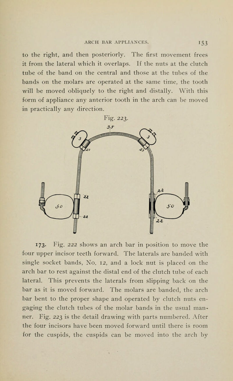 to the right, and then posteriorly. The first movement frees it from the lateral which it overlaps. If the nuts at the clutch tube of the band on the central and those at the tubes of the bands on the molars are operated at the same time, the tooth will be moved obliquely to the right and distally. With this form of appliance any anterior tooth in the arch can be moved in practically any direction. Fig. 223. 3S J73- Fig- 222 shows an arch bar in position to move the four upper incisor teeth forward. The laterals are banded with single socket bands, No. 12, and a lock nut is placed on the arch bar to rest against the distal end of the clutch tube of each lateral. This prevents the laterals from slipping back on the bar as it is moved forward. The molars are banded, the arch bar bent to the proper shape and operated by clutch nuts en- gaging the clutch tubes of the molar bands in the usual man- ner. Fig. 223 is the detail drawing with parts numbered. After the four incisors have been moved forward until there is room for the cuspids, the cuspids can be moved into the arch by