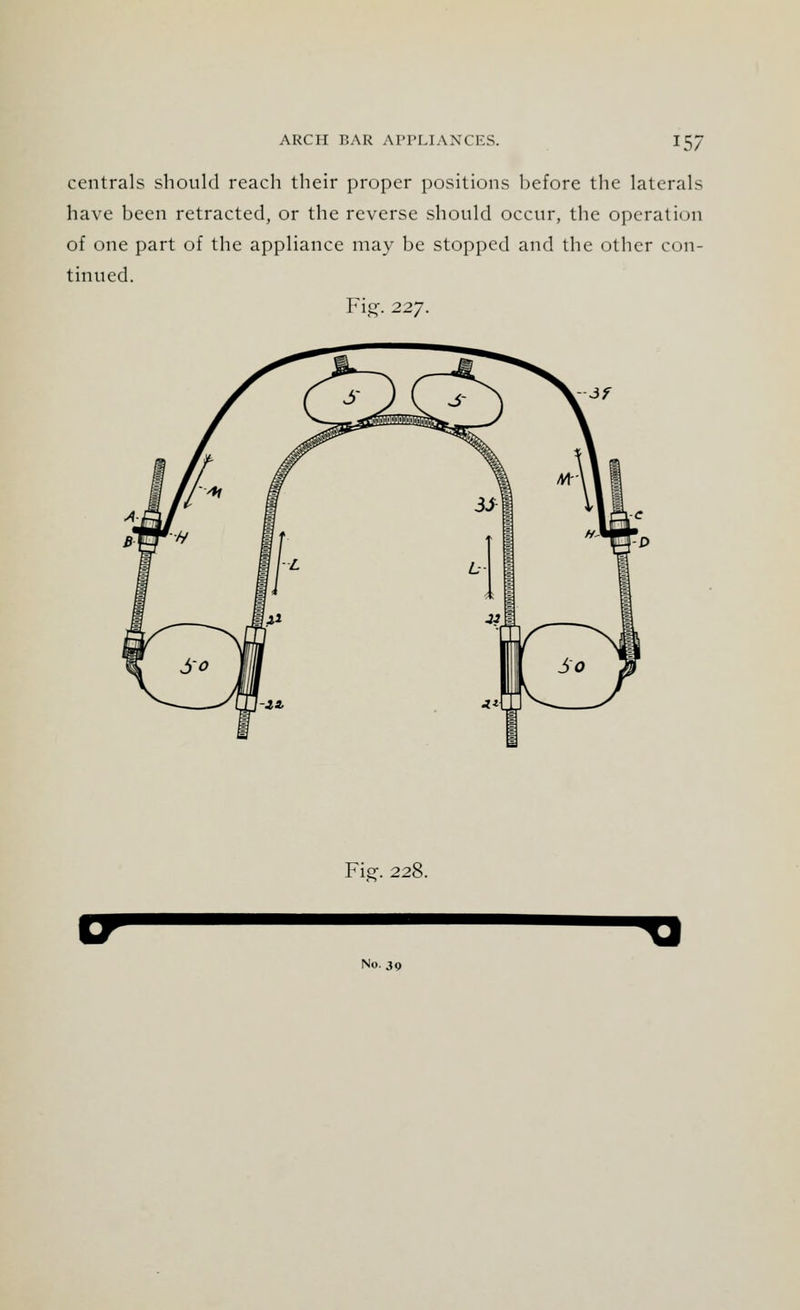 centrals should reach their proper positions before the laterals have been retracted, or the reverse should occur, the operation of one part of the appliance may be stopped and the other con- tinned. Fig. 227. Fie. 22i No. 30 Tl