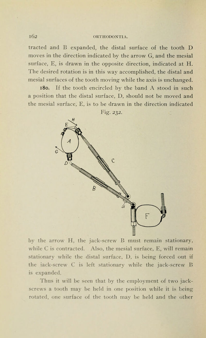 tracted and B expanded, the distal surface of the tooth D moves in the direction indicated by the arrow G, and the mesial surface, E, is drawn in the opposite direction, indicated at H. The desired rotation is in this way accomplished, the distal and mesial surfaces of the tooth moving- while the axis is unchanged. 180. If the tooth encircled by the band A stood in such a position that the distal surface, D, should not be moved and the mesial surface, E, is to be drawn in the direction indicated Fig. 232. H by the arrow II. the jack-screw B must remain stationary, while C is contracted. Also, the mesial surface, E, will remain stationary while the distal surface, I), is being forced <>ut if the iack-screw C is lefl stationary while the jack-screw B panded. Thus it will be seen that by the employment of two jack- tooth may be held in one position while it is being rotated, one surface of the tooth mav be held and the other