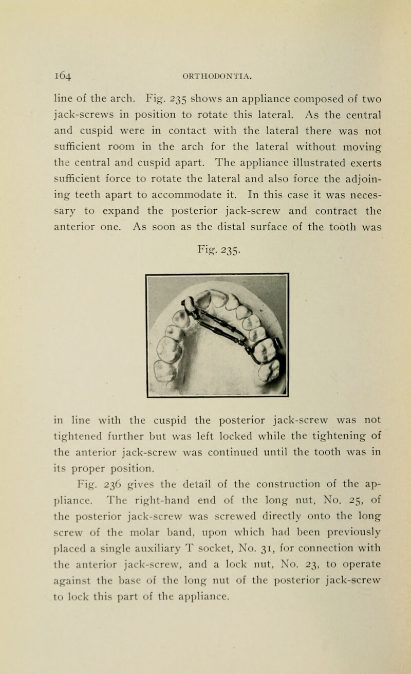 line of the arch. Fig. 235 shows an appliance composed of two jack-screws in position to rotate this lateral. As the central and cuspid were in contact with the lateral there was not sufficient room in the arch for the lateral without moving the central and cuspid apart. The appliance illustrated exerts sufficient force to rotate the lateral and also force the adjoin- ing teeth apart to accommodate it. In this case it was neces- sary to expand the posterior jack-screw and contract the anterior one. As soon as the distal surface of the tooth was Fig. 235. in line with the cuspid the posterior jack-screw was not tightened further but was left locked while the tightening of the anterior jack-screw was continued until the tooth was in its proper position. Fig. 236 gives the detail of the construction of the ap- pliance. The right-hand end of the long nut, No. 25, of the posterior jack-screw was screwed directly onto the long screw of the molar hand, upon which had been previously placed a single auxiliary T socket, No. 31, for connection with the anterior jack-screw, and a lock nut. No. 23, to operate againsl the base of the long nut of the posterior jack-screw to lock 111 i^ pari of the appliance.