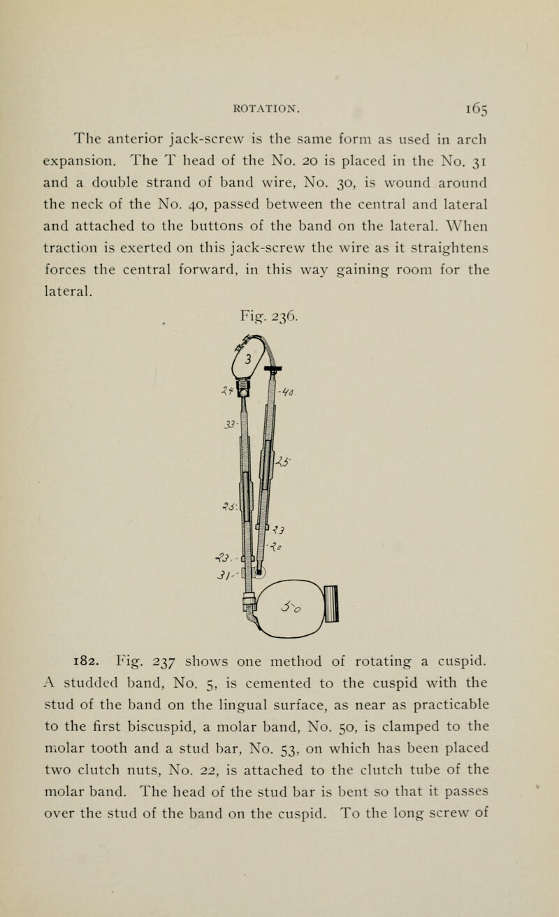 The anterior jack-screw is the same form as used in arch expansion. The T head of the No. 20 is placed in the No. 31 and a double strand of band wire, No. 30, is wound around the neck of the No. 40, passed between the central and lateral and attached to the buttons of the band on the lateral. When traction is exerted on this jack-screw the wire as it straightens forces the central forward, in this way gaining room for the lateral. Fig. 236. 182. Fig. 237 shows one method of rotating a cuspid. A studded band, No. 5, is cemented to the cuspid with the stud of the band on the lingual surface, as near as practicable to the first biscuspid, a molar band, No. 50, is clamped to the molar tooth and a stud bar, No. 53, on which has been placed two clutch nuts, No. 22, is attached to the clutch tube of the molar band. The head of the stud bar is bent so that it passes over the stud of the band on the cuspid. To the long screw of