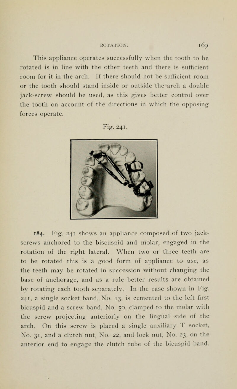 This appliance operates successfully when the tooth to be rotated is in line with the other teeth and there is sufficient room for it in the arch. If there should not he sufficient room or the tooth should stand inside or outside the arch a double jack-screw should be used, as this gives better control over the tooth on account of the directions in which the opposing forces operate. Fig. 241. 184. Fig. 241 shows an appliance composed of two jack- screws anchored to the biscuspid and molar, engaged in the rotation of the right lateral. When two or three teeth are to be rotated this is a good form of appliance to use, as the teeth may be rotated in succession without changing the base of anchorage, and as a rule better results are obtained by rotating each tooth separately. In the case shown in Fig. 241, a single socket band, No. 13, is cemented to the left first bicuspid and a screw band, No. 50, clamped to the molar with the screw projecting anteriorly on the lingual side of the arch. On this screw is placed a single auxiliary T socket, No. 31, and a clutch nut. No. 22, and lock nut. No. 2^, on the anterior end to engage the clutch tube of the bicuspid band.