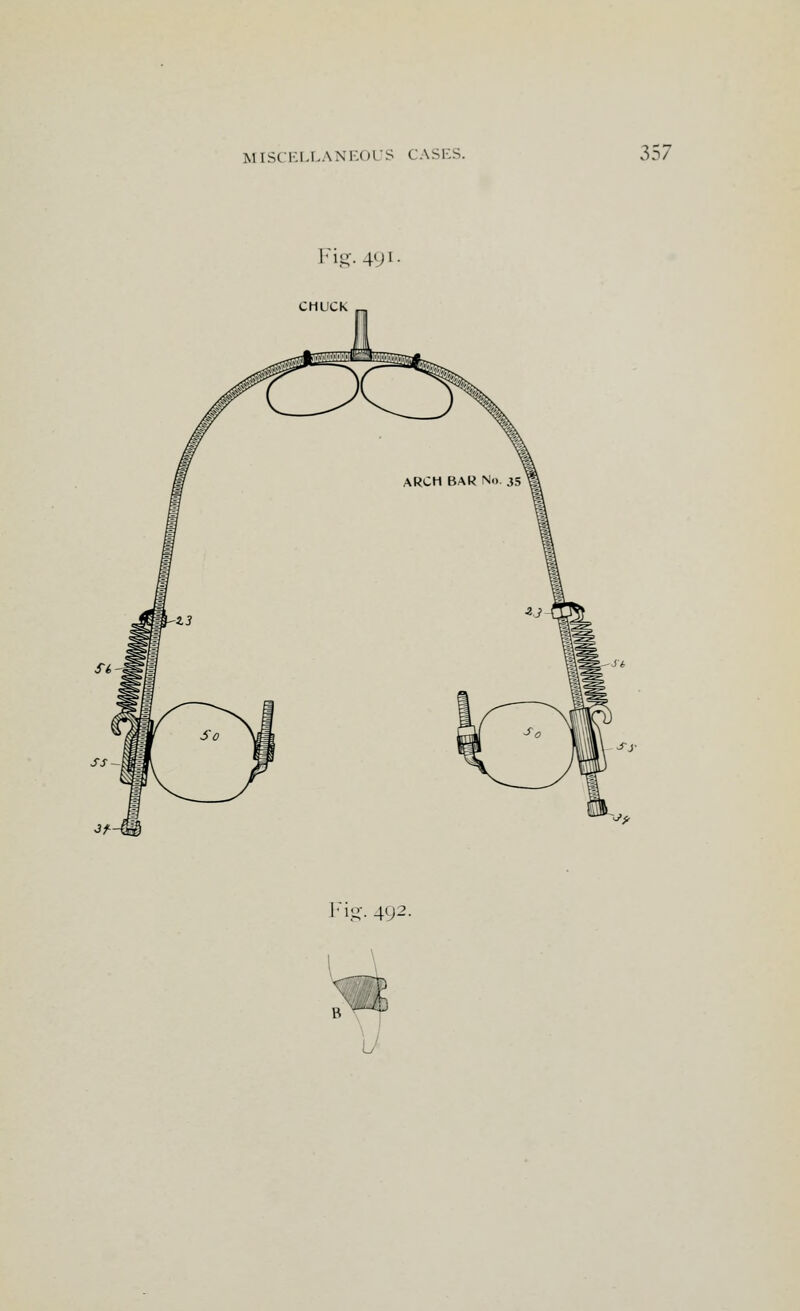 Fig-491 CHUCk Fig. 4(P- L